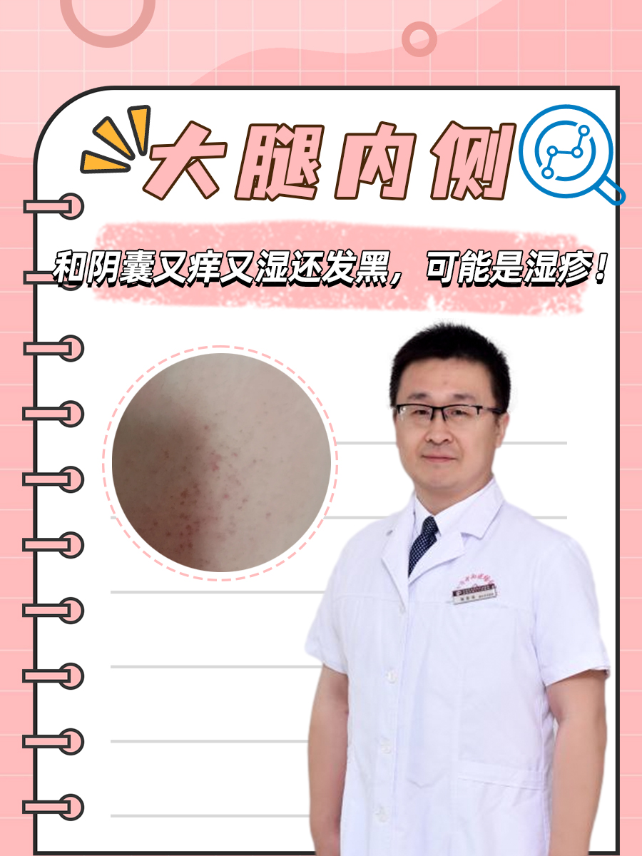 裆部的两侧发红和瘙痒