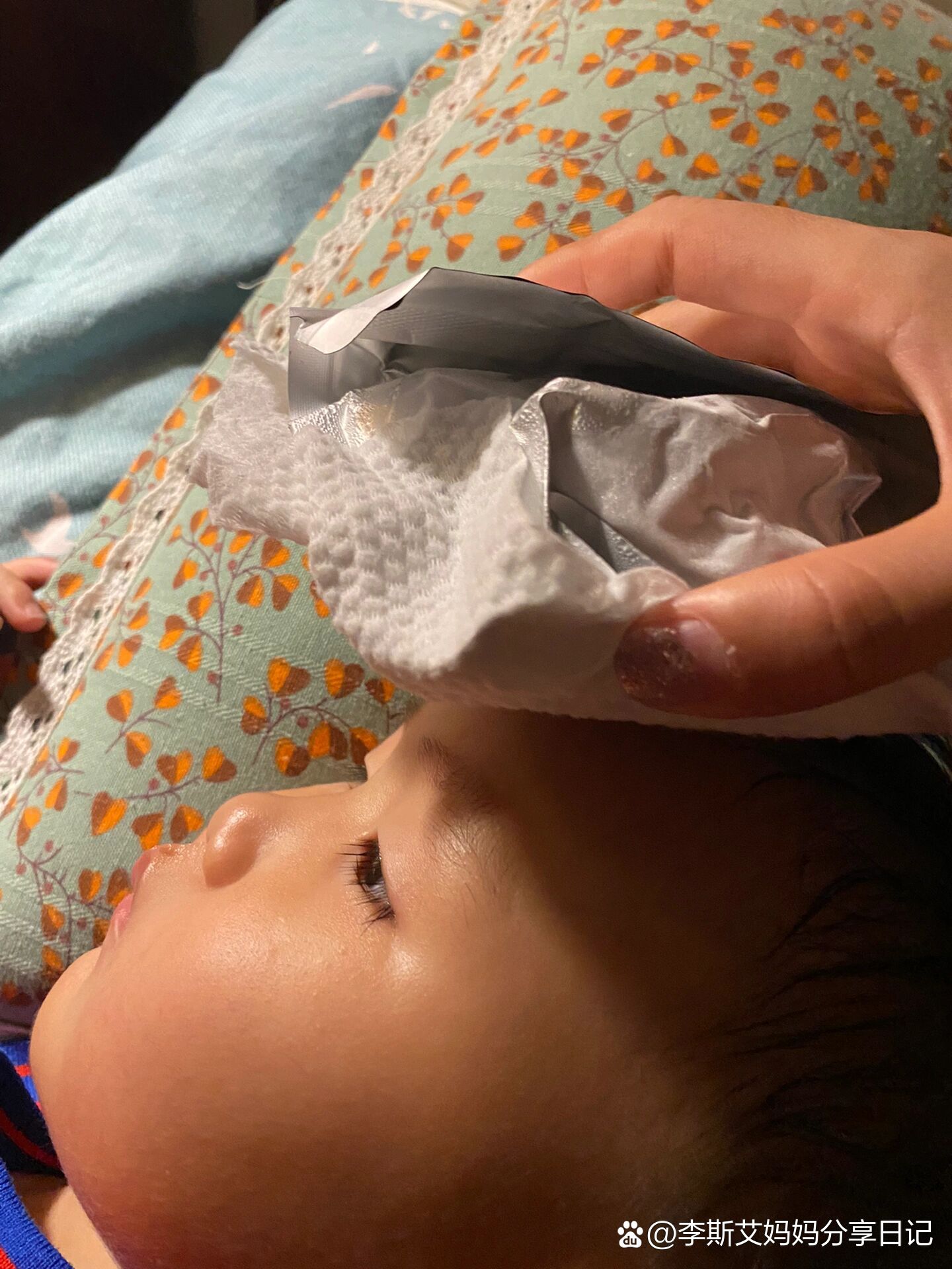 宝宝头部磕了个包,如何消肿