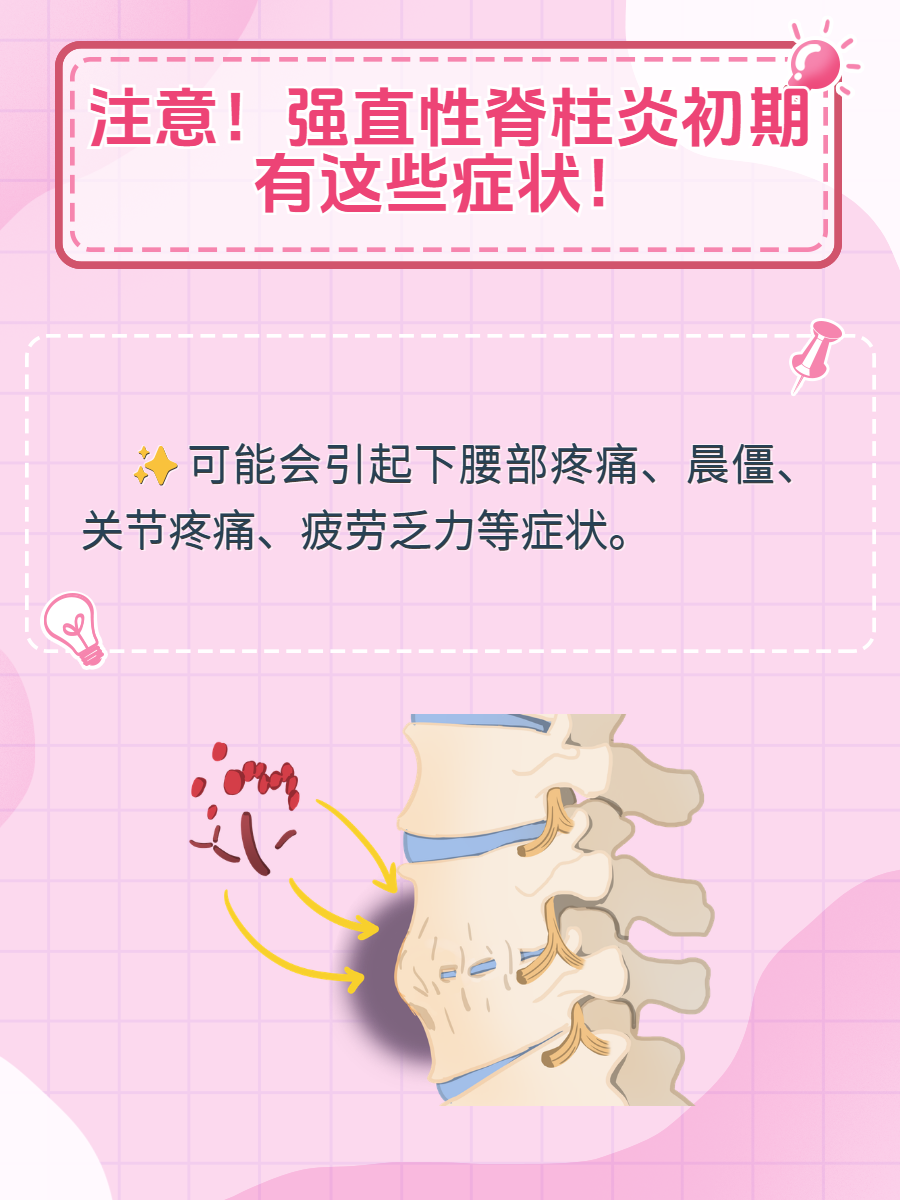 强直性脊柱炎怎么检查出的