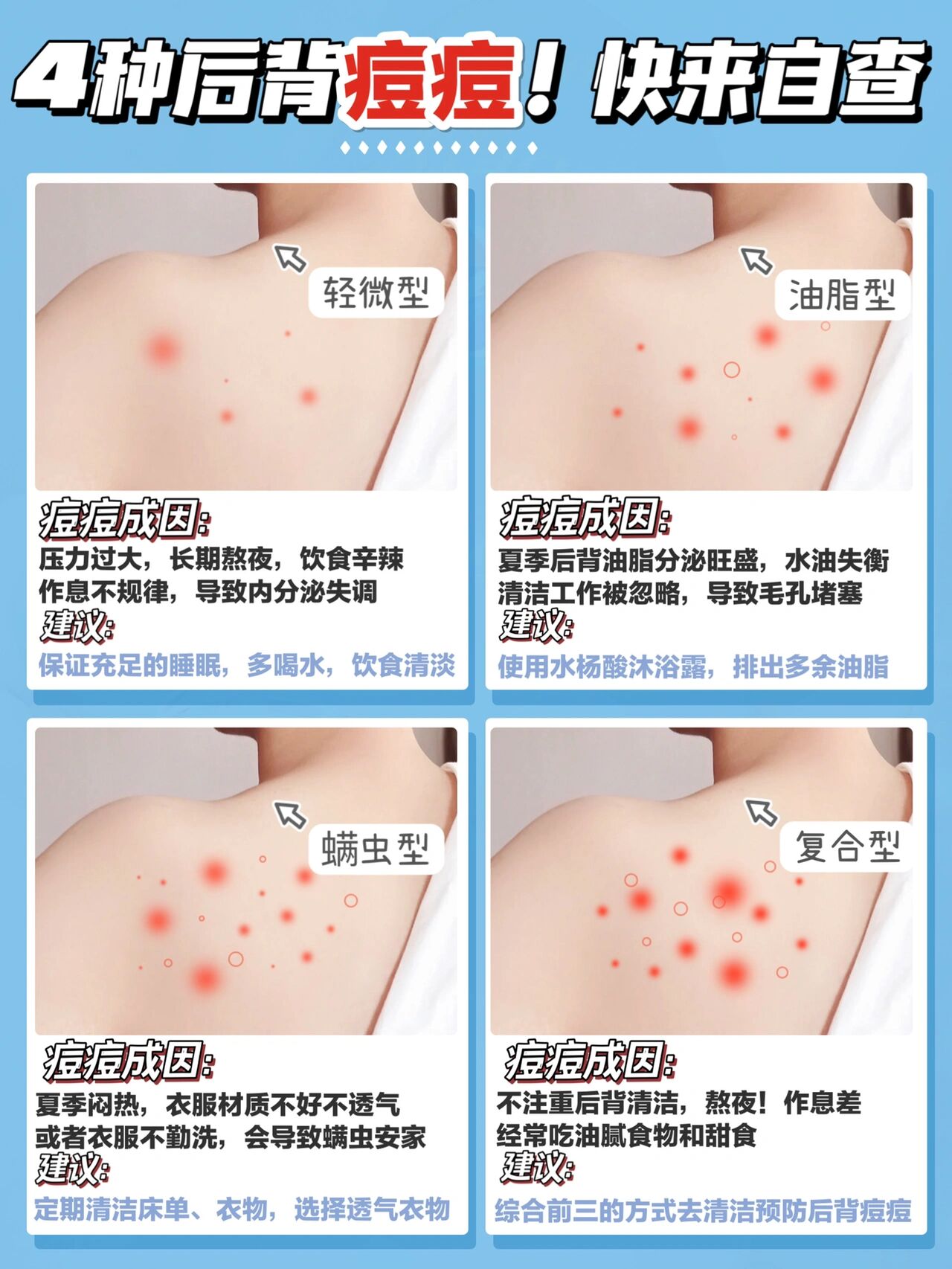 前胸后背长痘痘是什么原因引起的