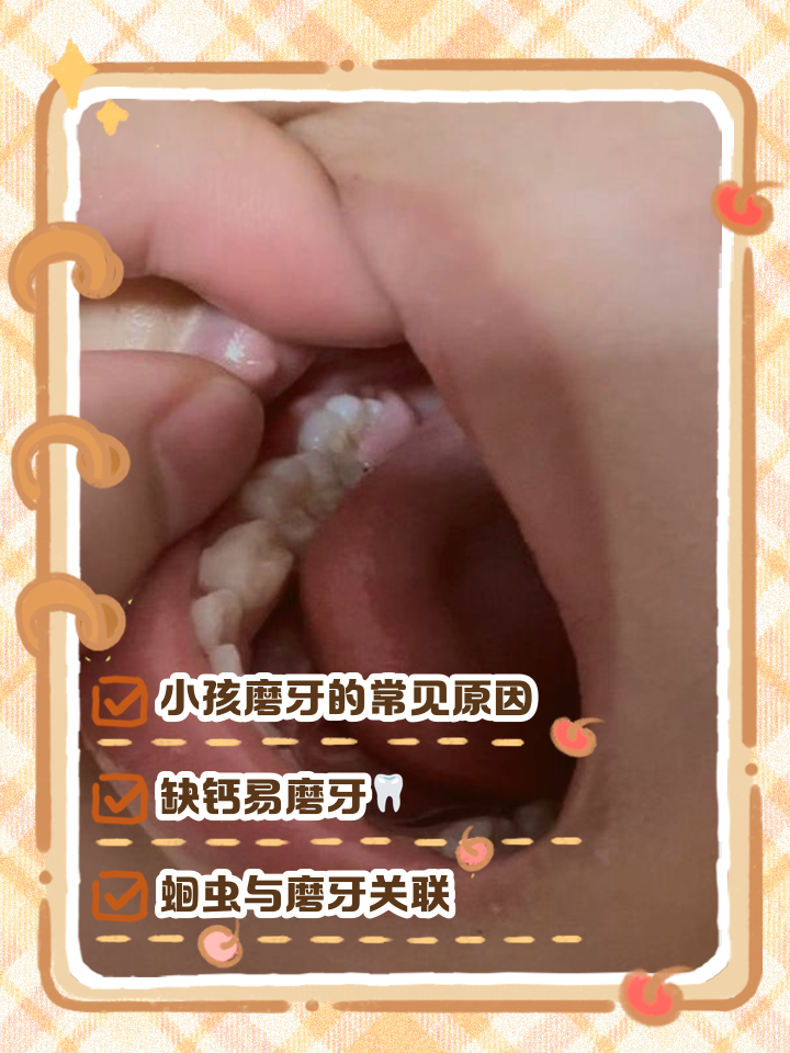 小孩睡觉磨牙是怎么回事?