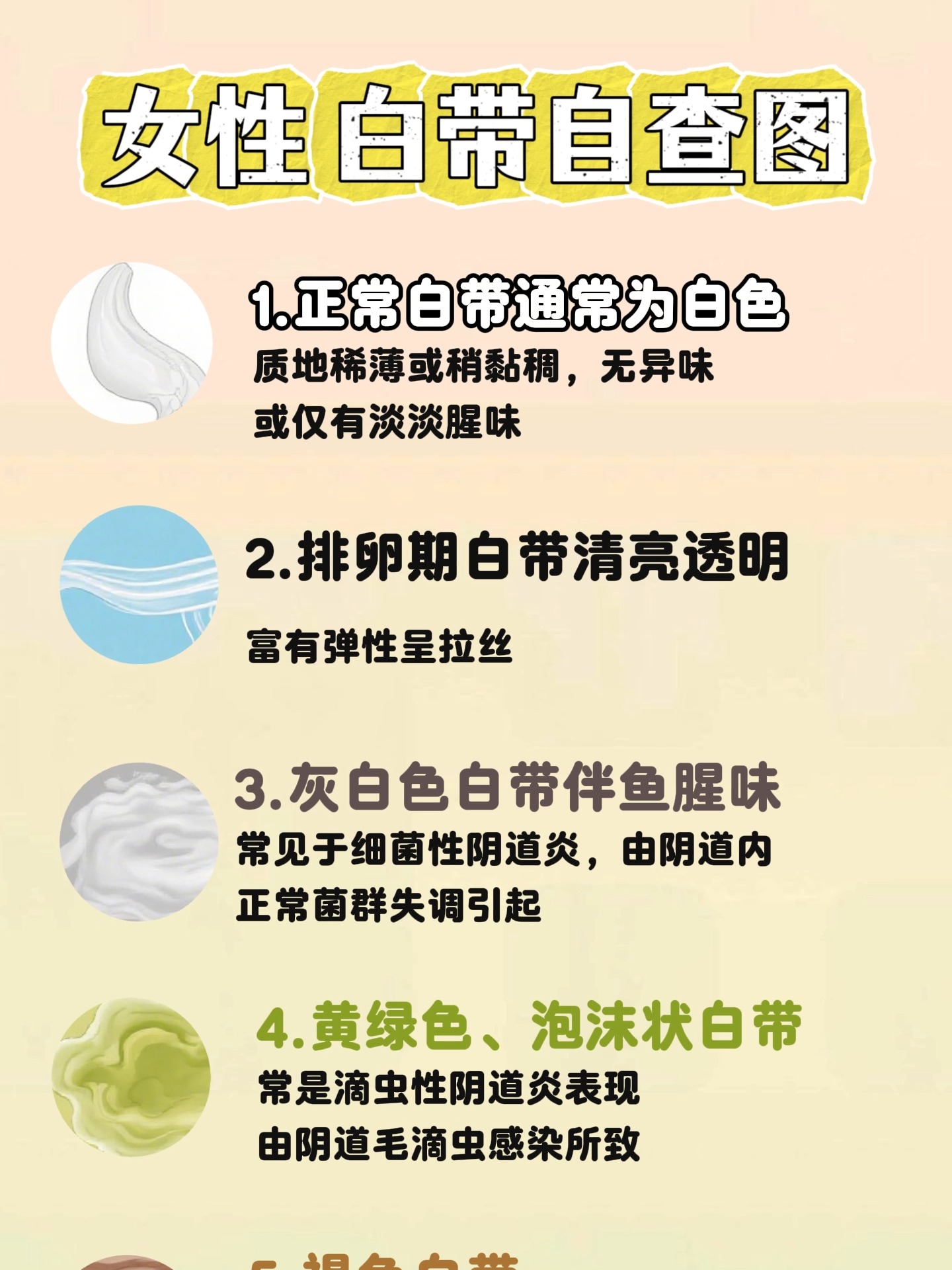 白带异常的原因