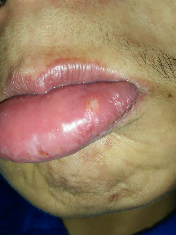 新生婴儿上火怎么办