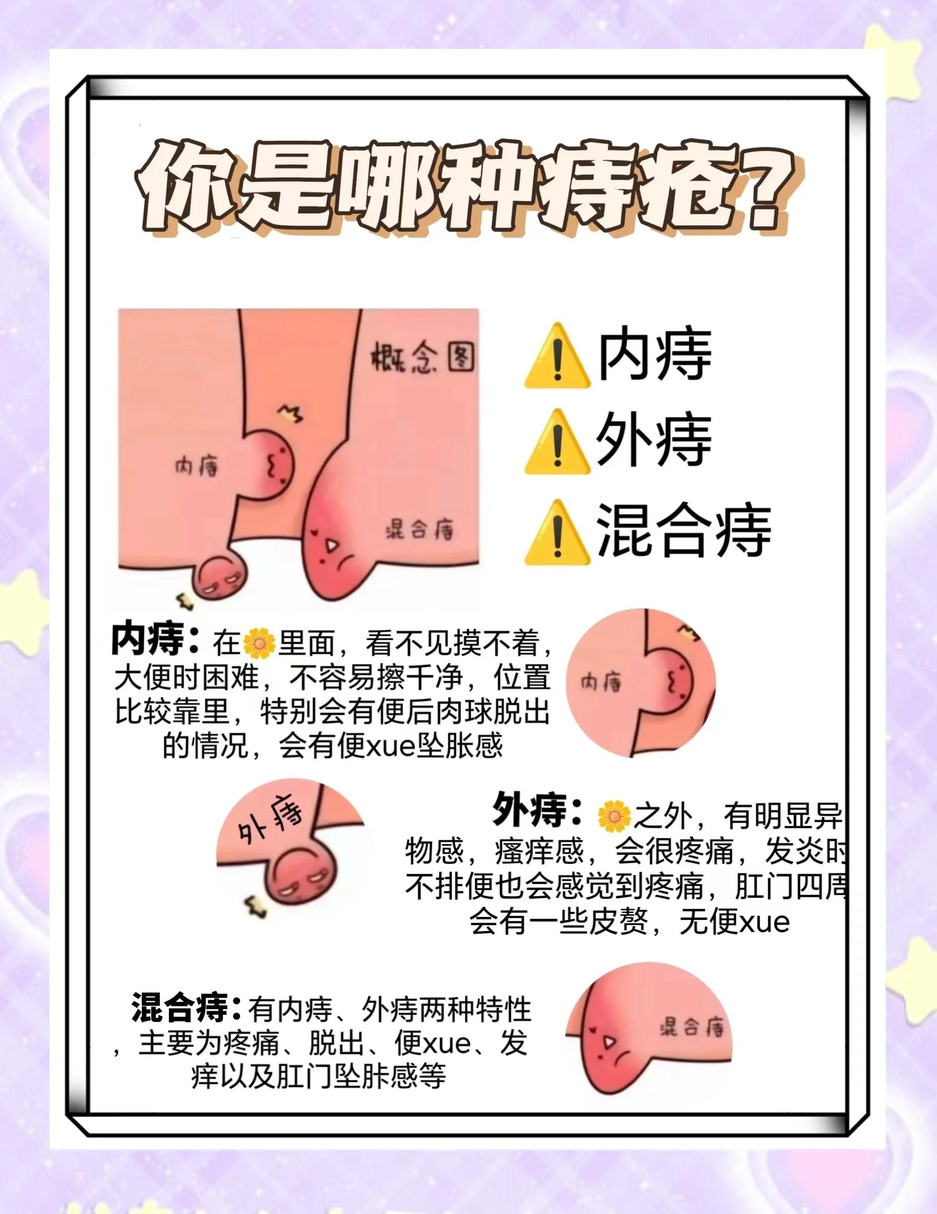 痔疮肿得厉害,非常疼,怎么办?