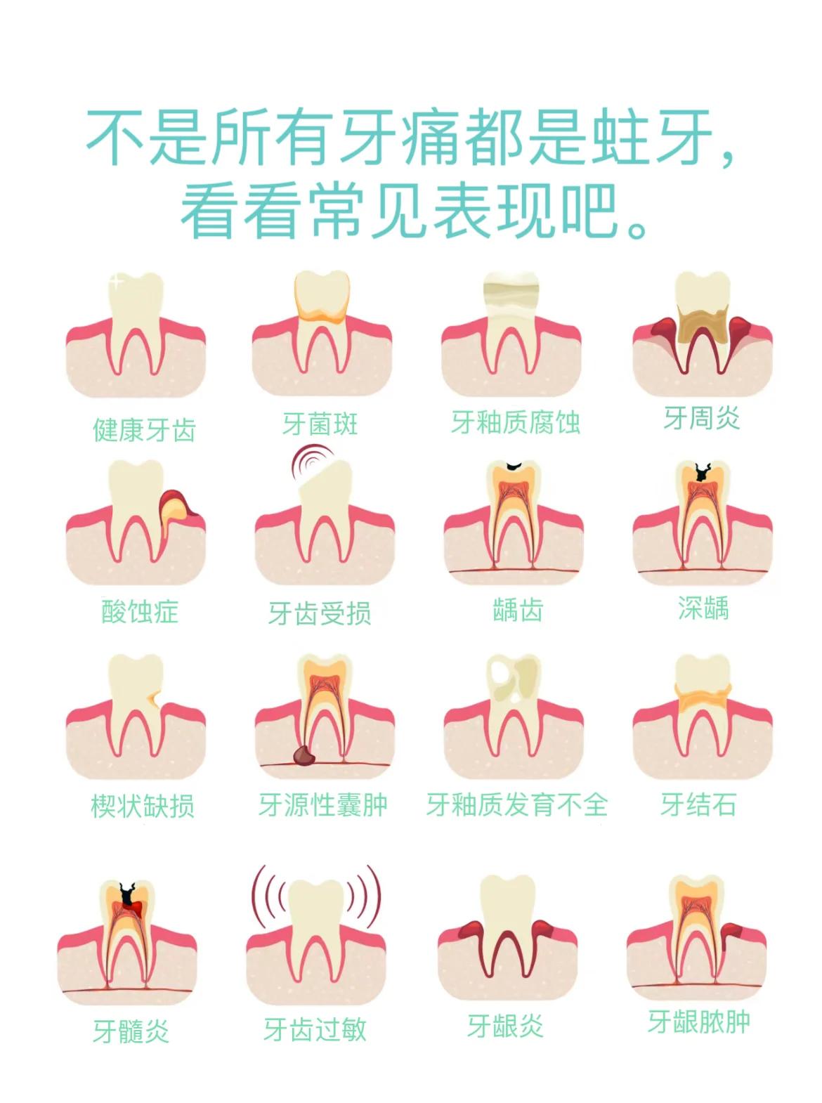 牙痛是由于什么引起的