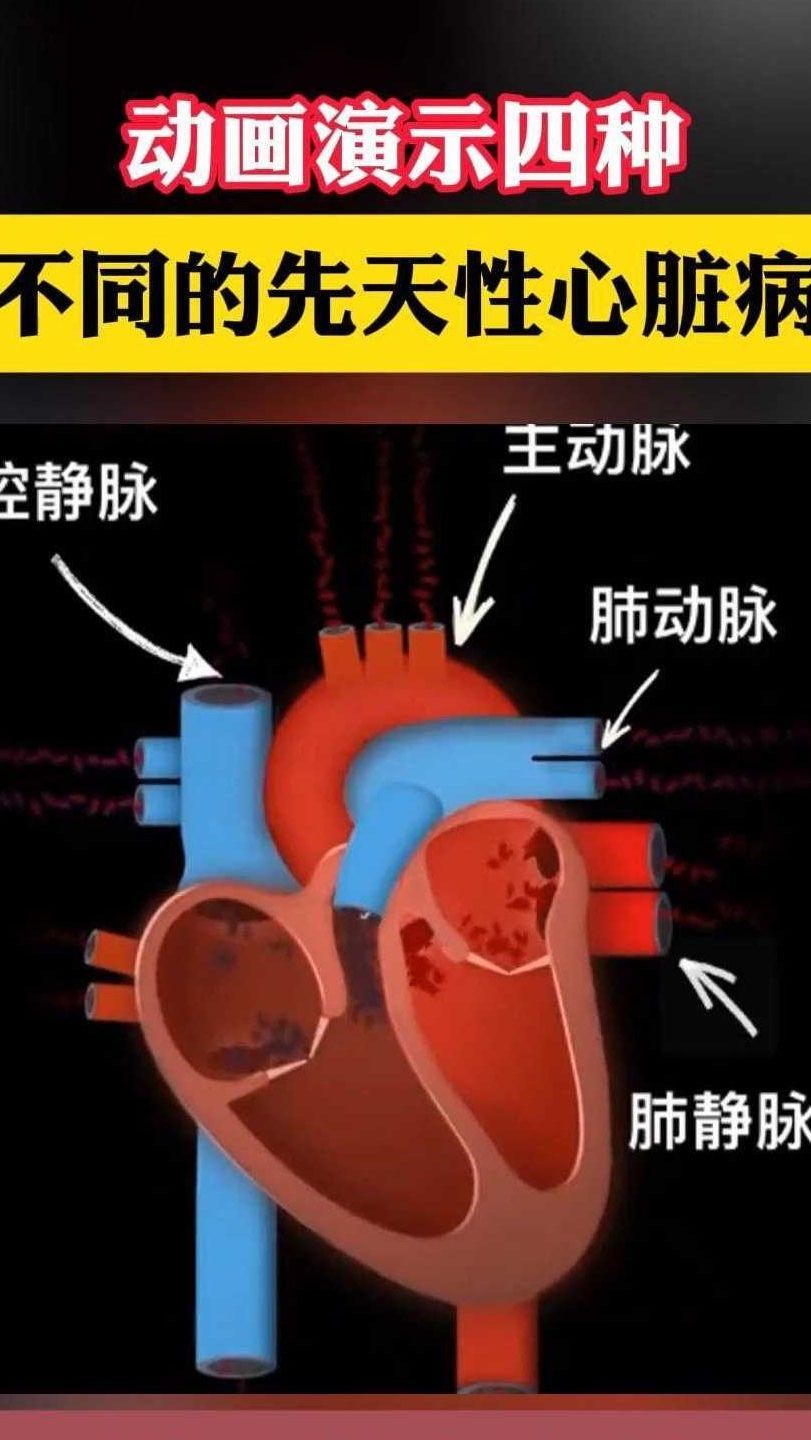心脏病的种类主要有哪些