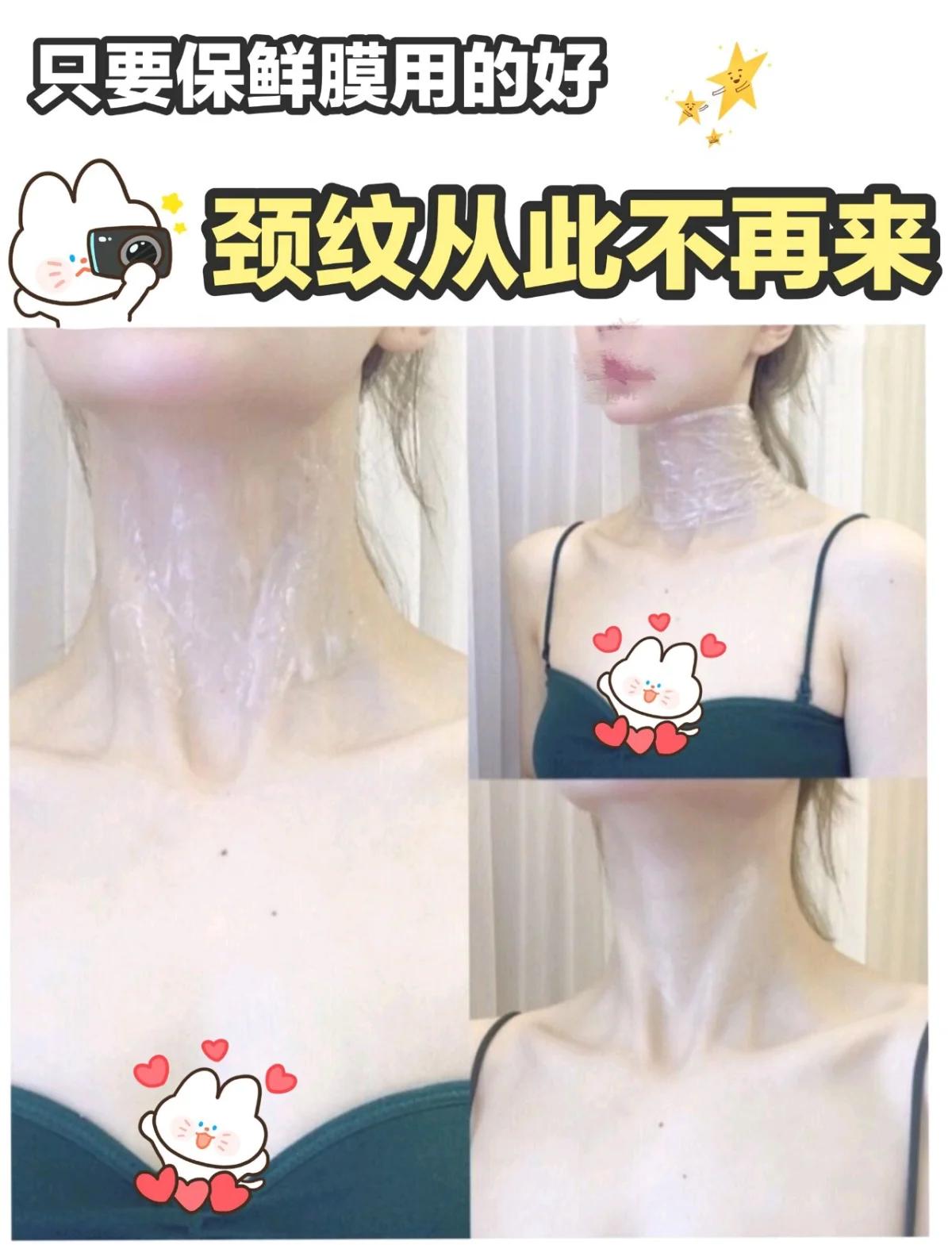 脖子上的草莓怎么快速去掉