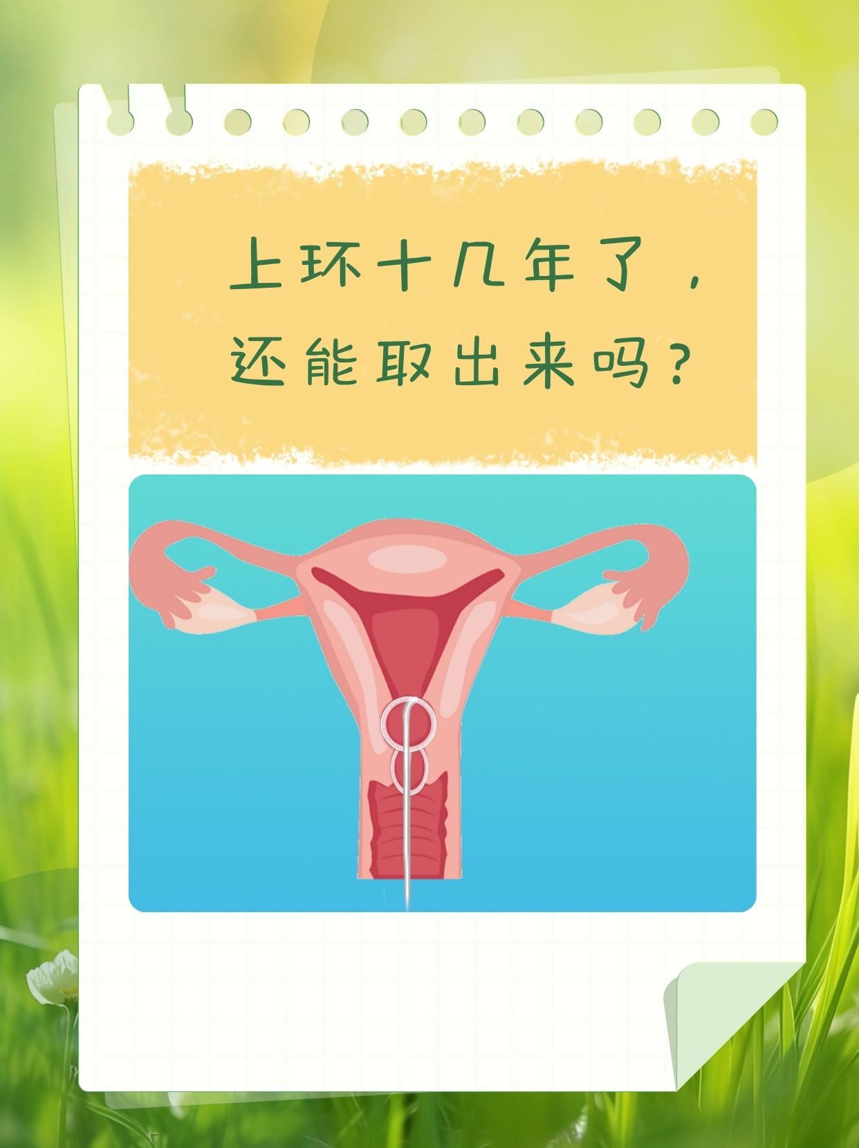 带环后还会怀孕吗