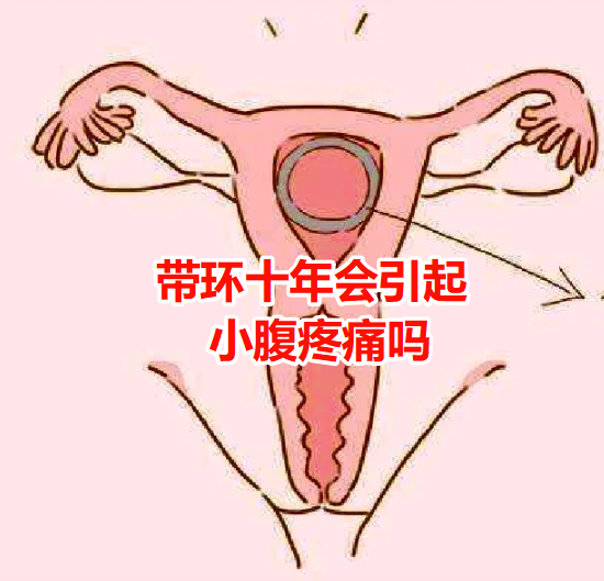 带环后还会怀孕吗