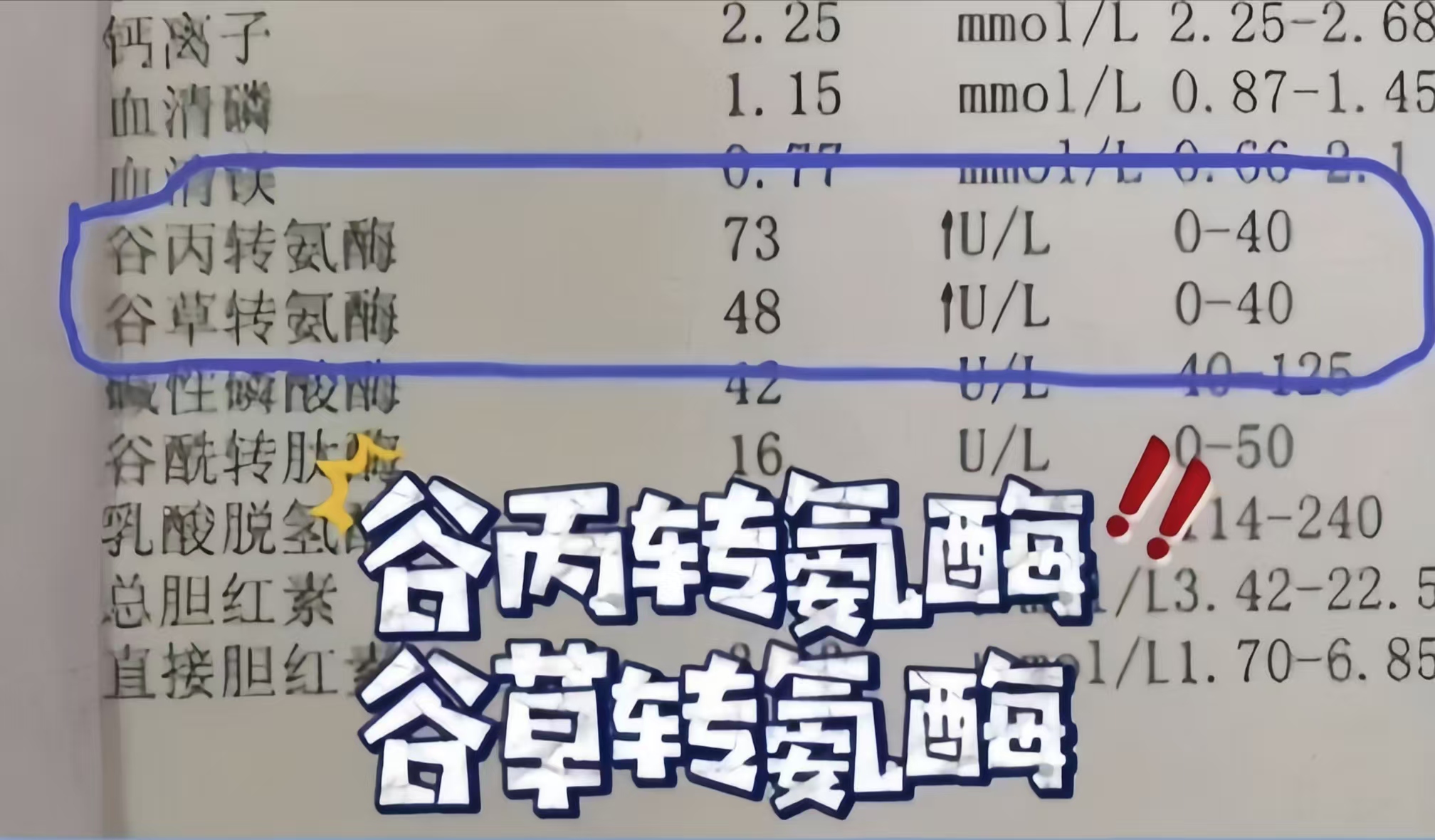 谷丙谷草偏低什么原因