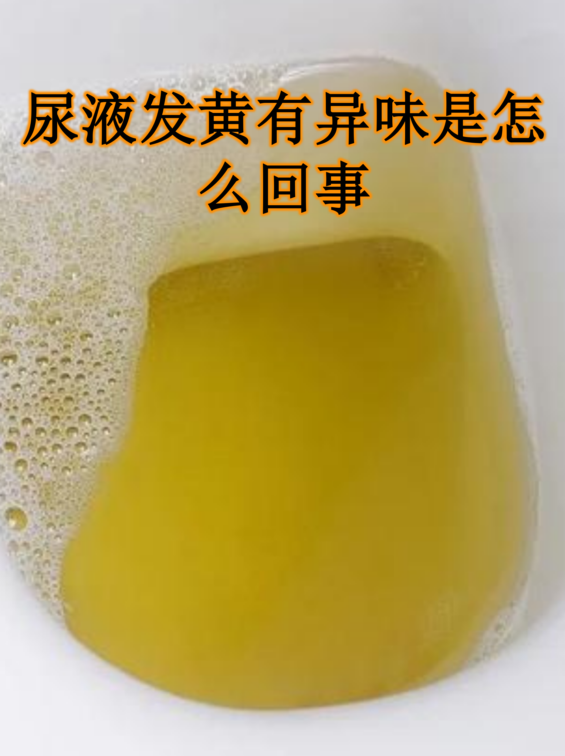 女性小便很黄是什么原因