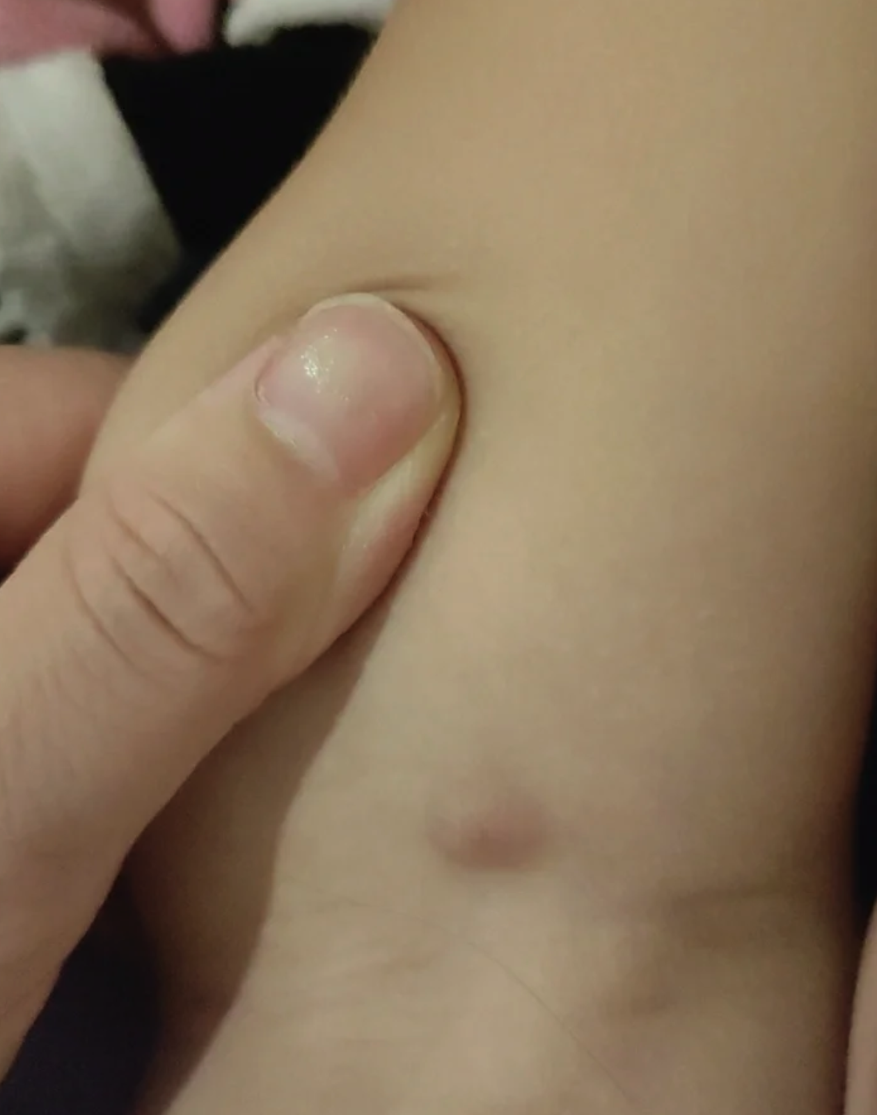 腋下有个疙瘩,按着就会痛