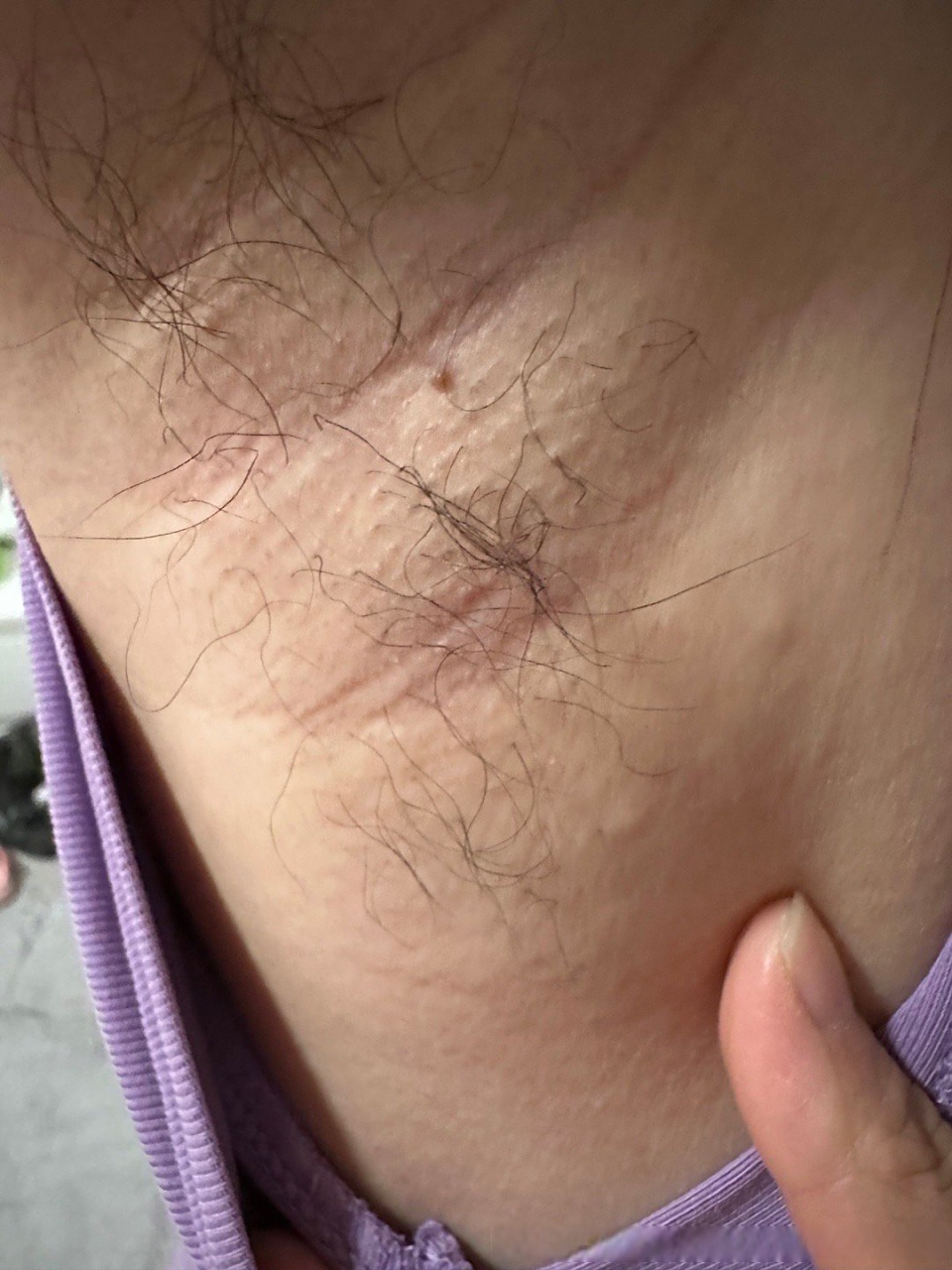 腋下有个疙瘩,按着就会痛