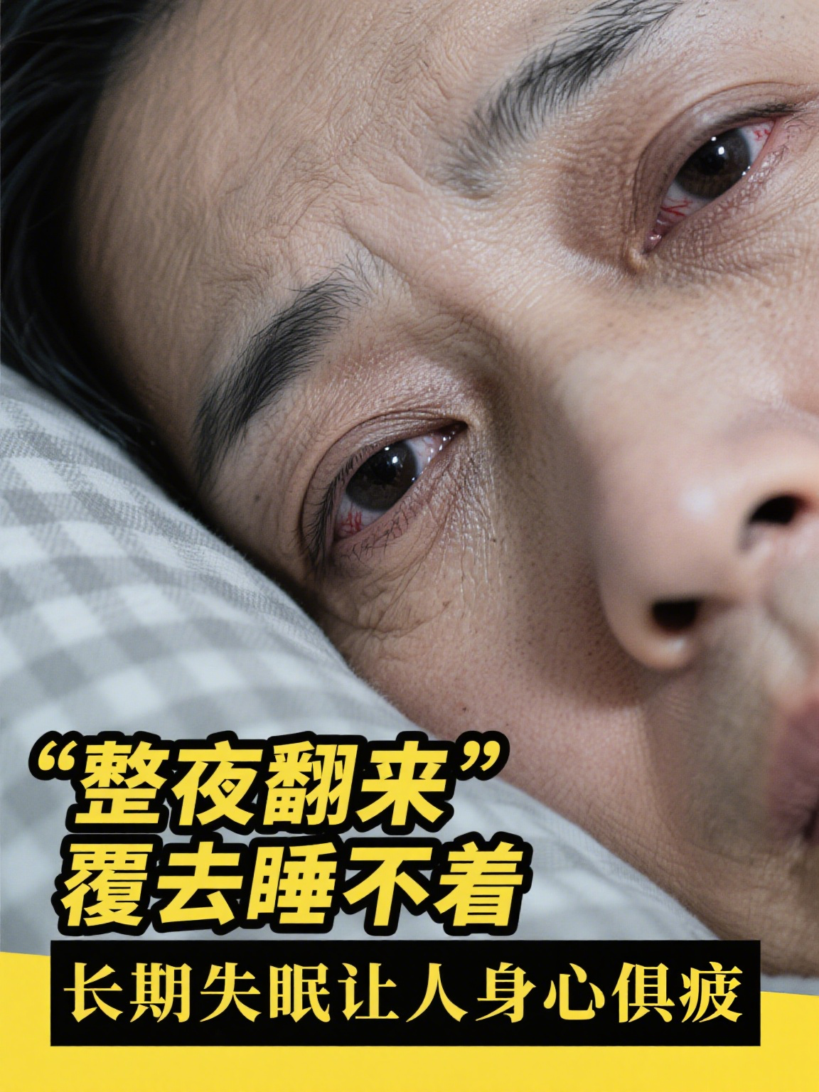 心理生理性失眠的临床表现