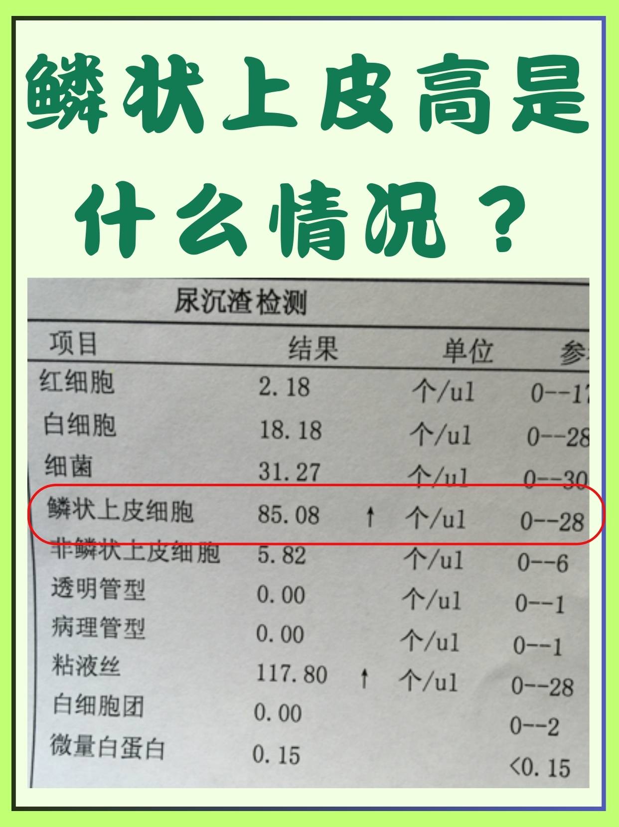 尿素高的原因有几种