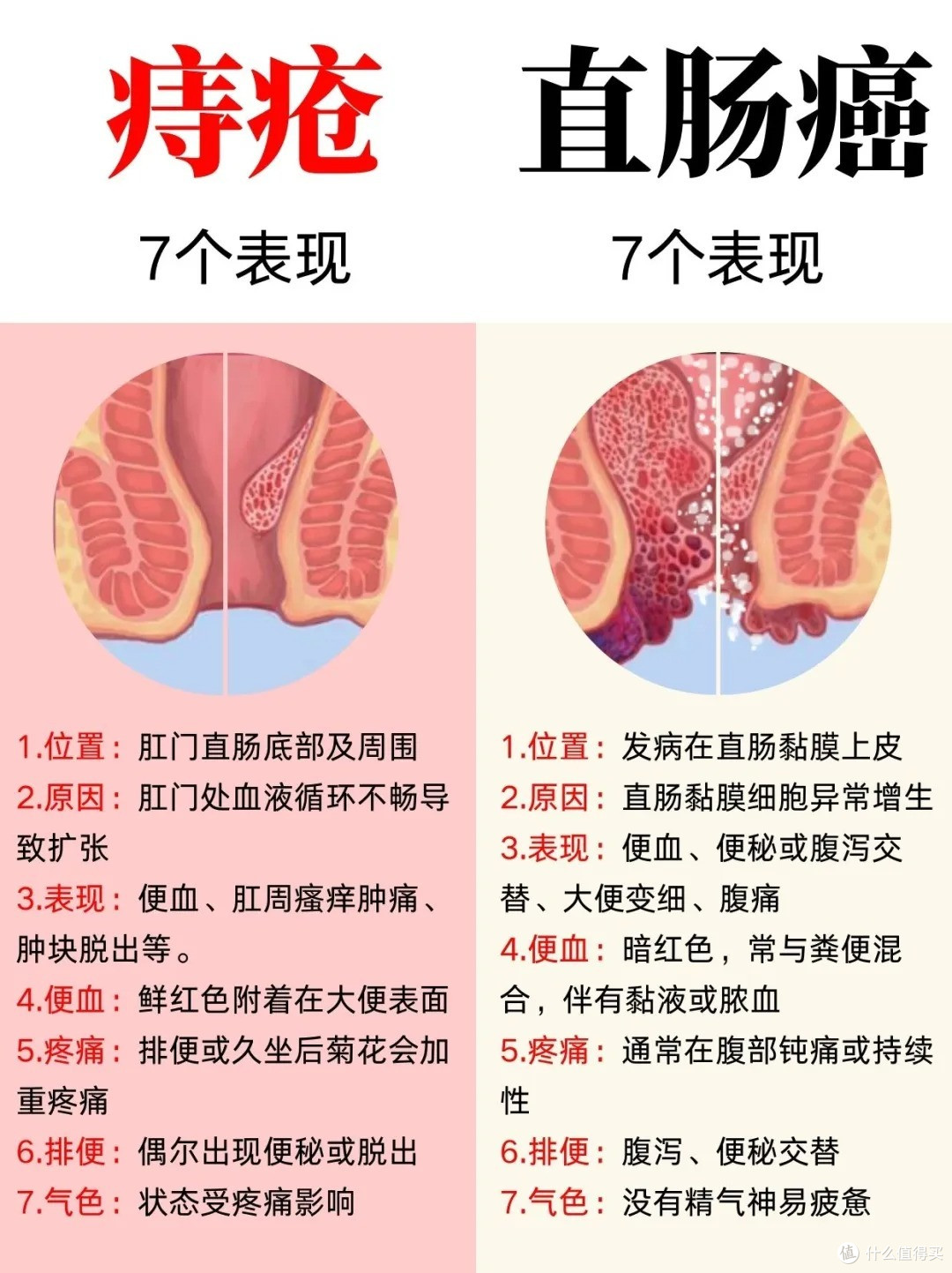 盲肠癌的早期症状