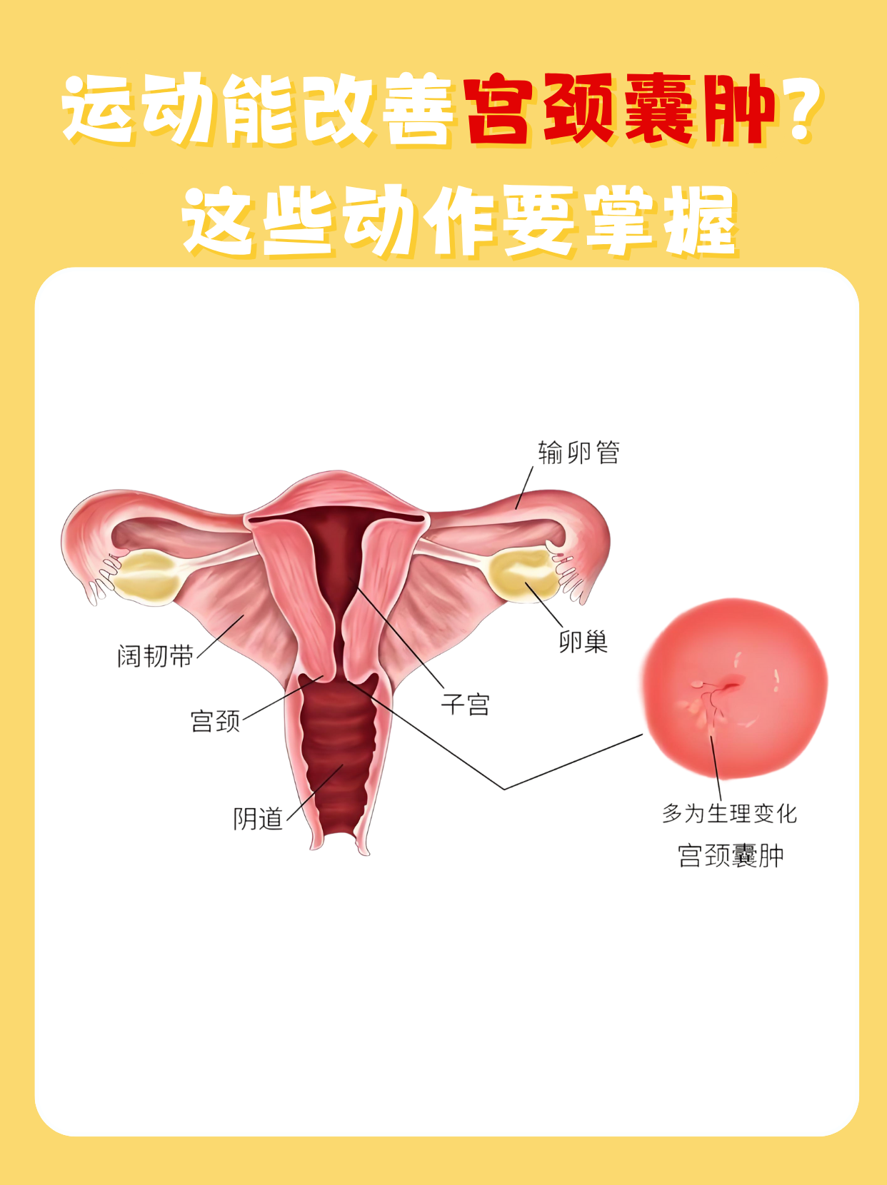 宫颈囊肿的治疗方法有哪些