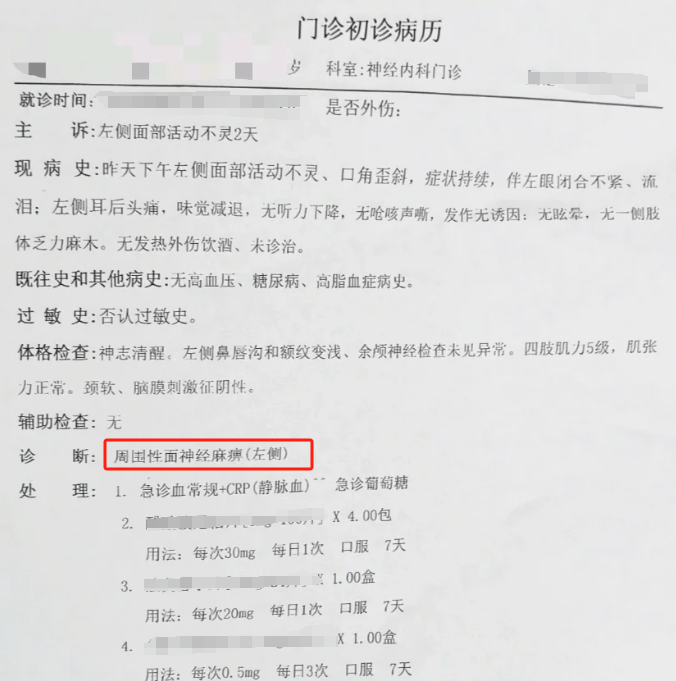 面神经炎多久能治愈