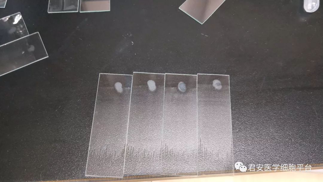 阴道里面有像2毫米左右的虫子是东西?