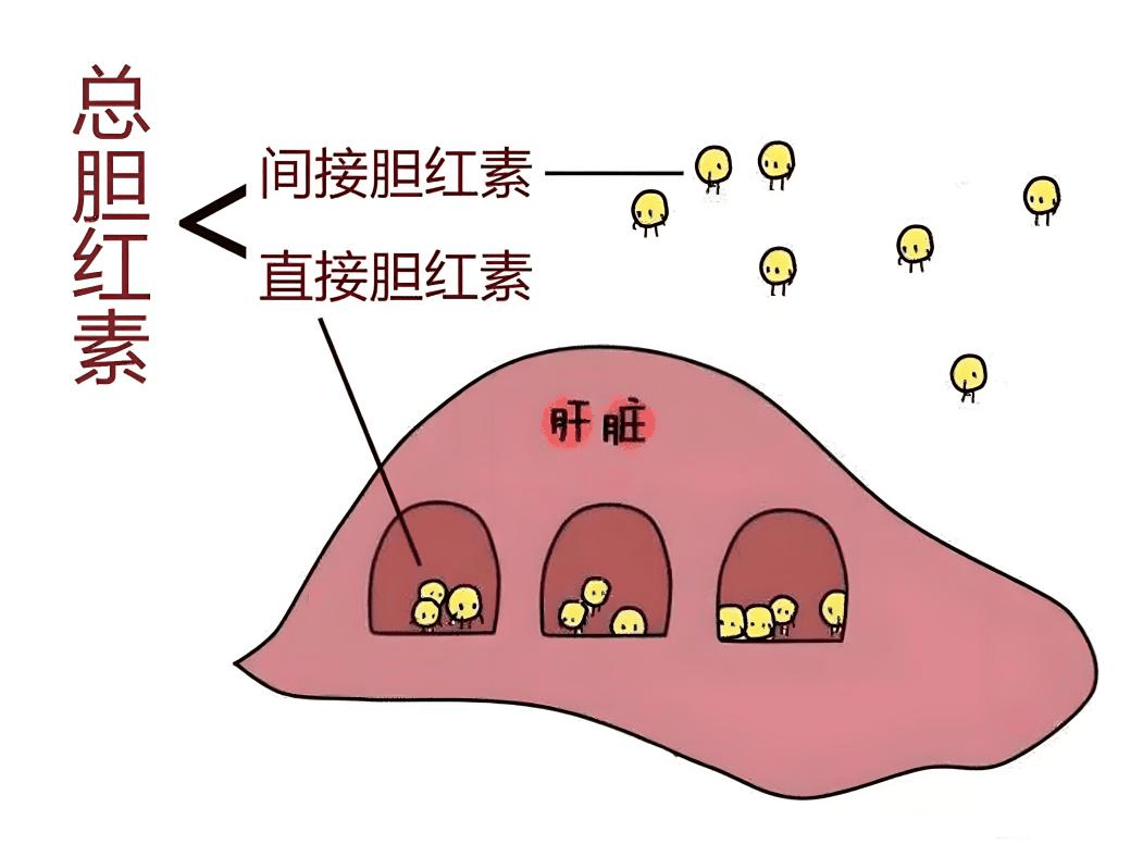 间接胆红素高,怎么能够快速降低