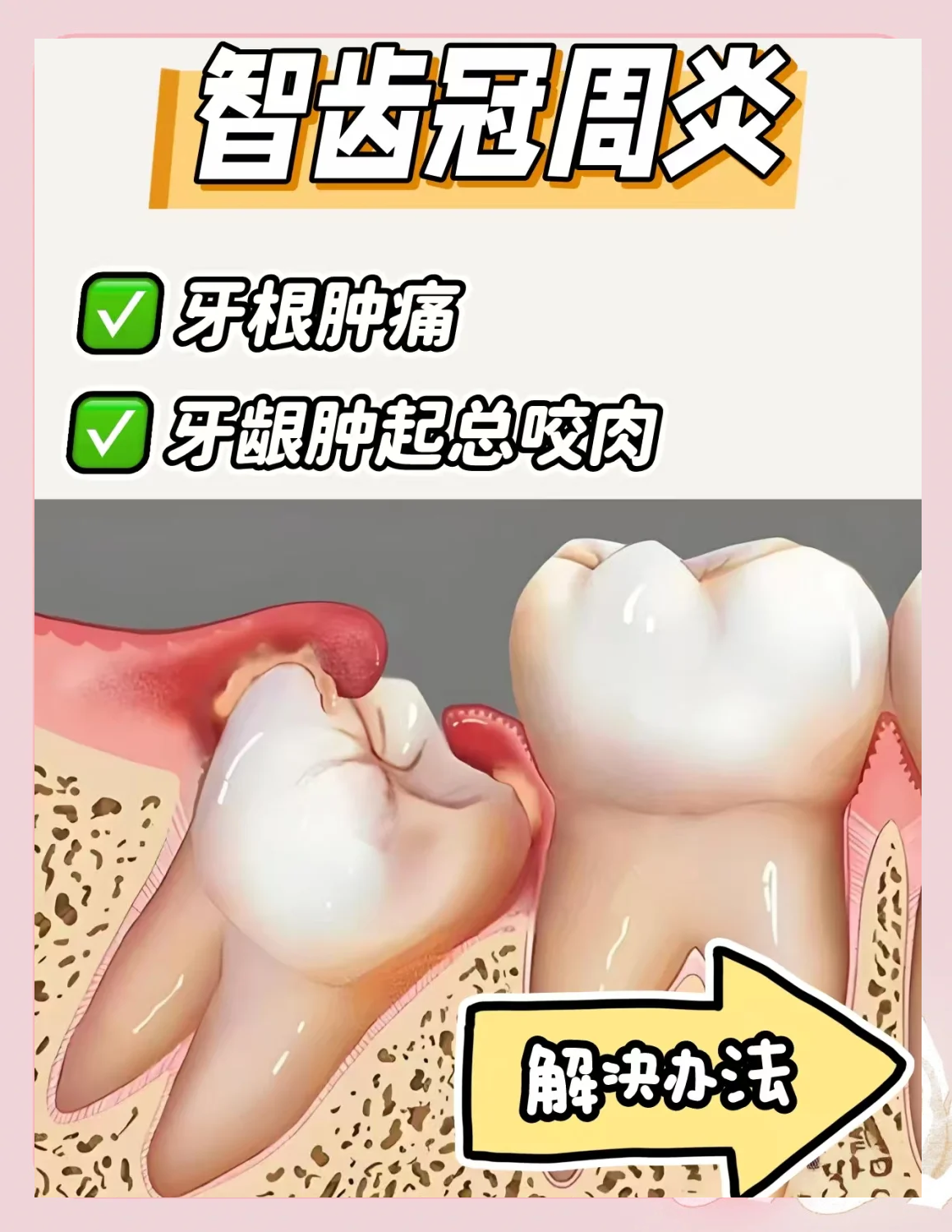 长智牙一般痛多久?