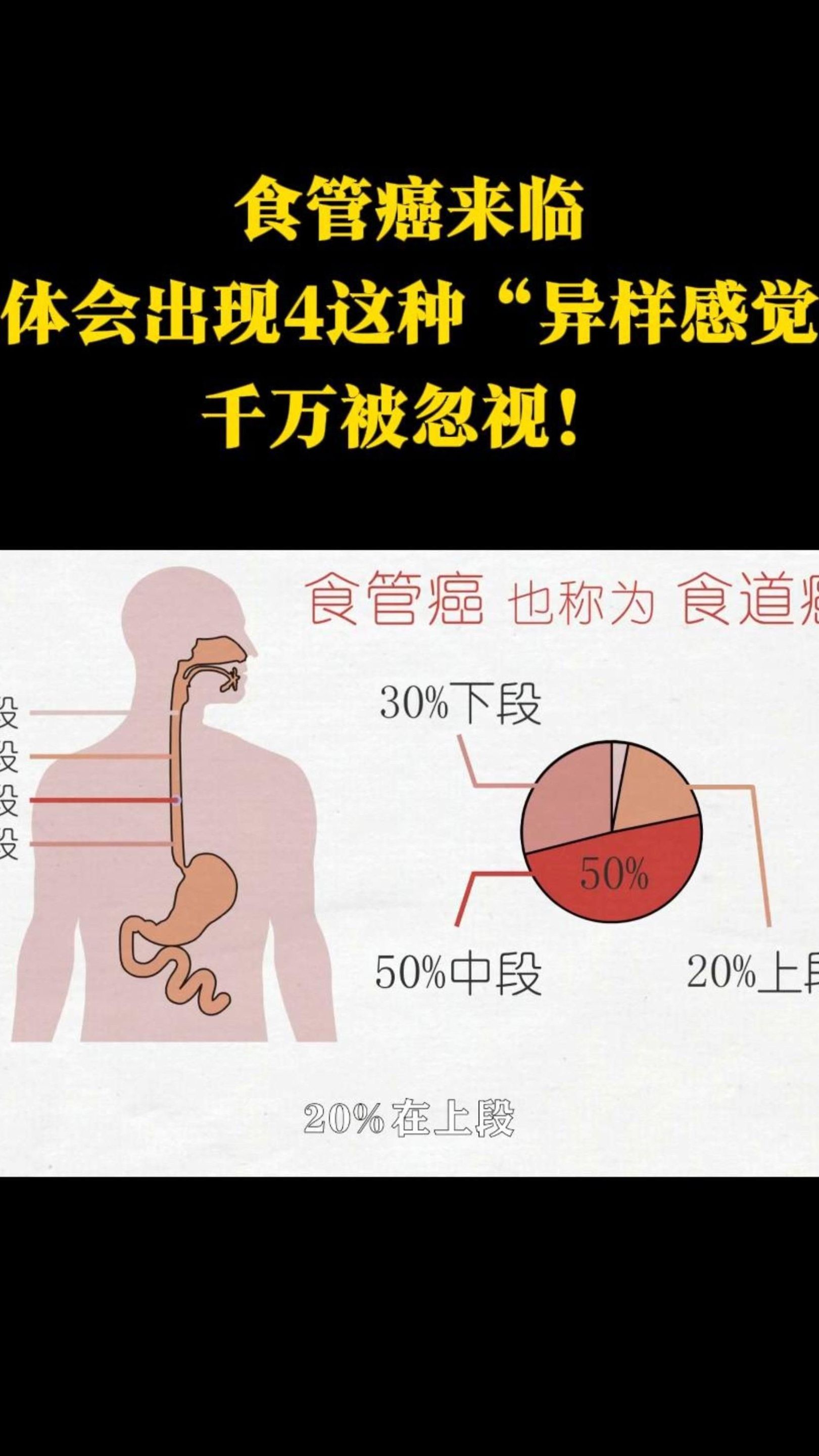 食道癌有什么症状