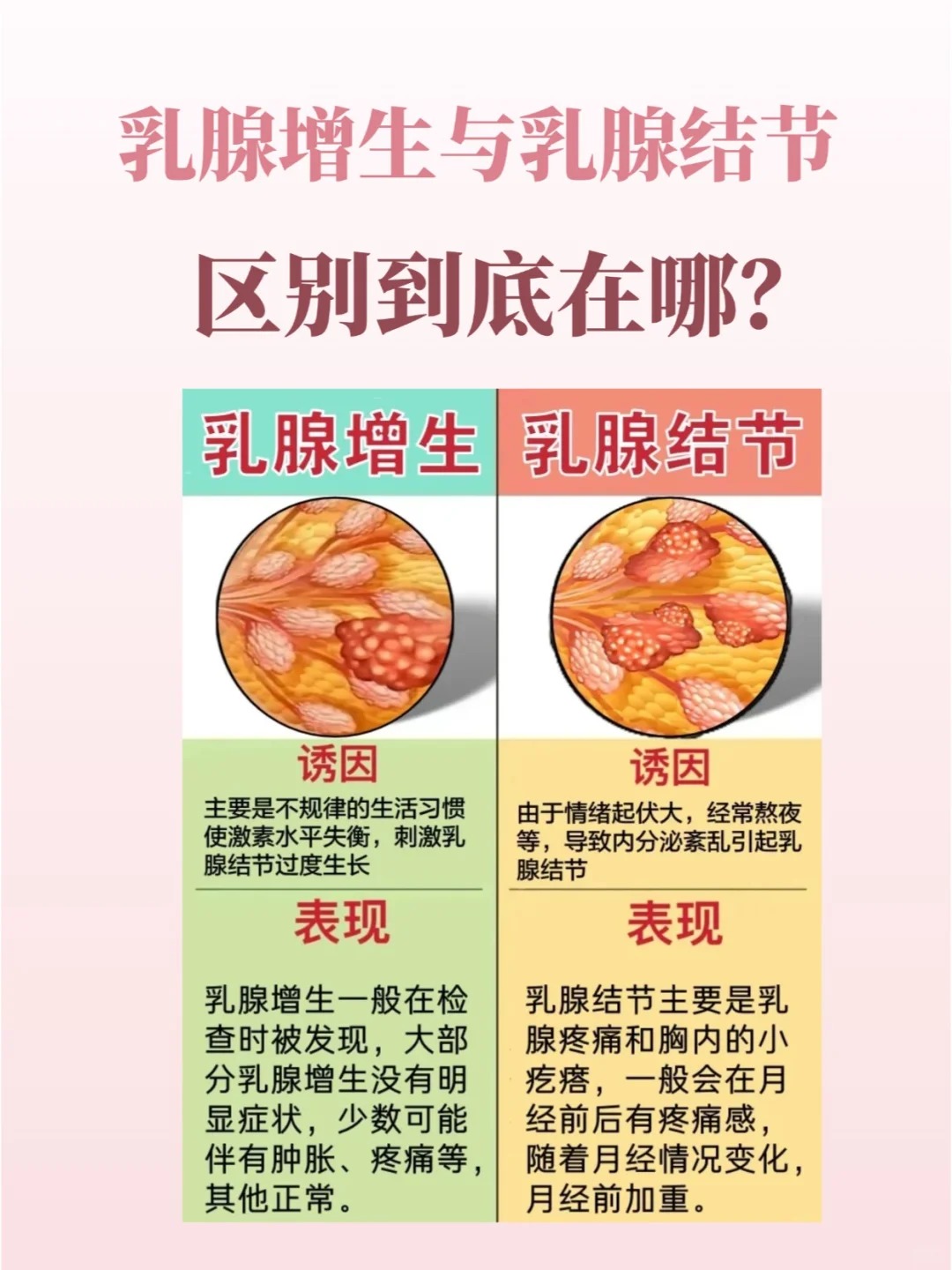 乳腺增生和结节有什么区别