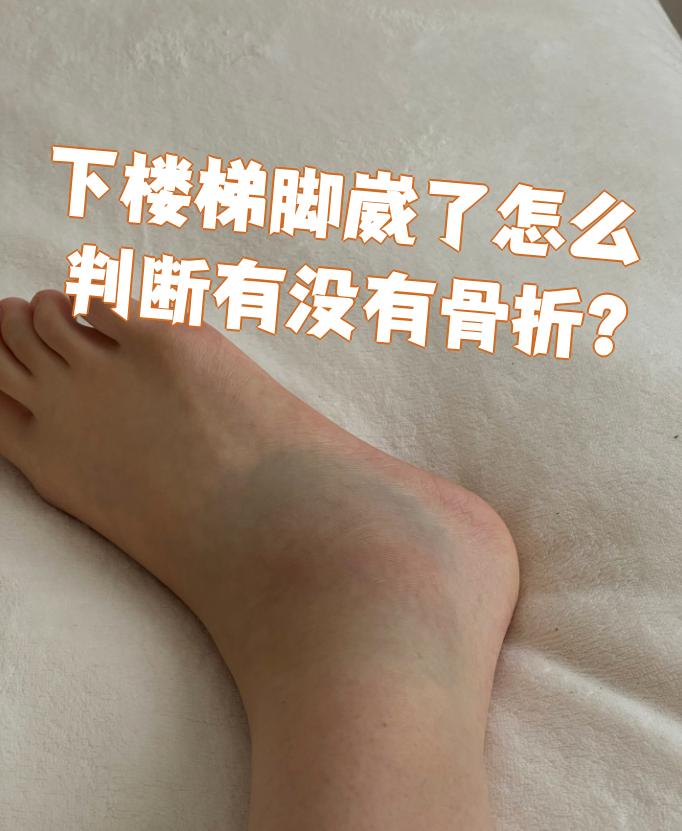 骨折的症状有哪些