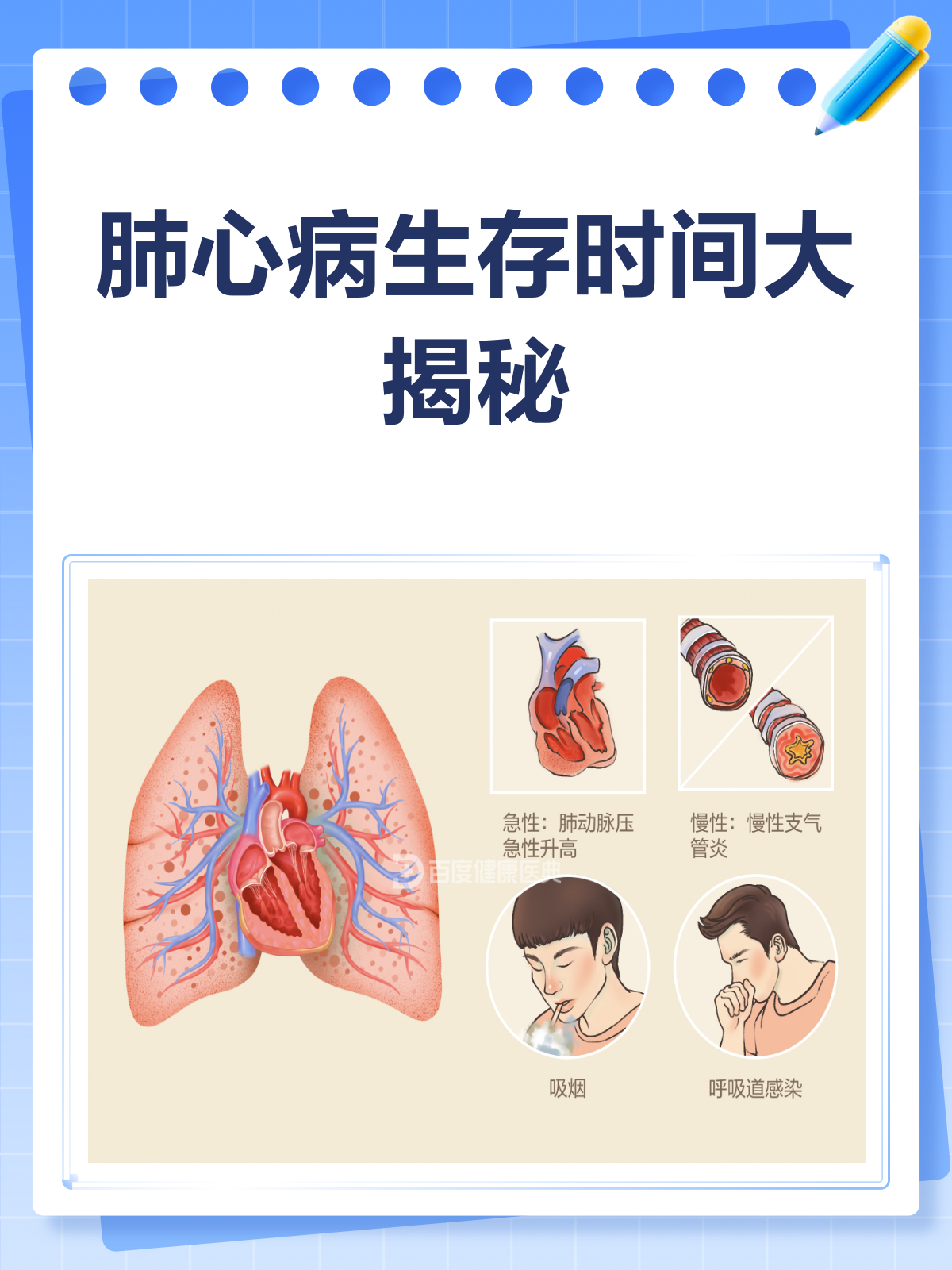 肺心病治疗方法都有哪些?