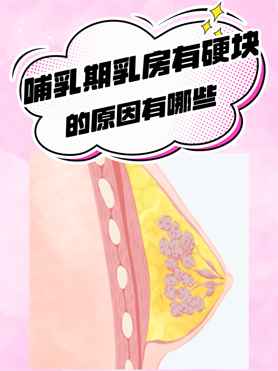 胸部乳头硬是怎么回事