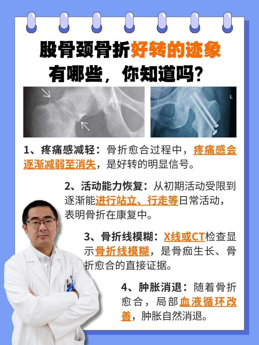 股骨颈骨折可以治愈吗?