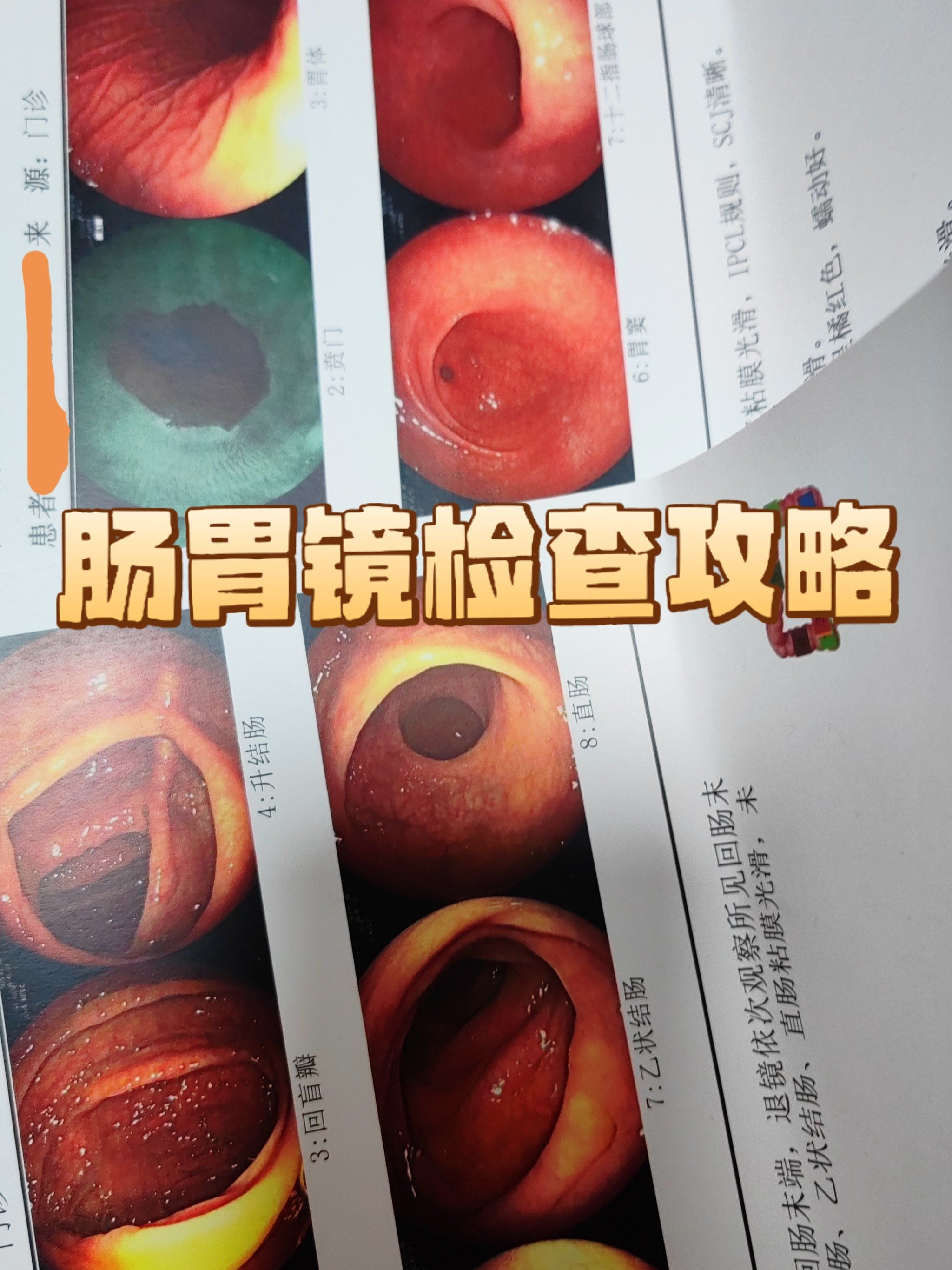 什么情况下做胃镜