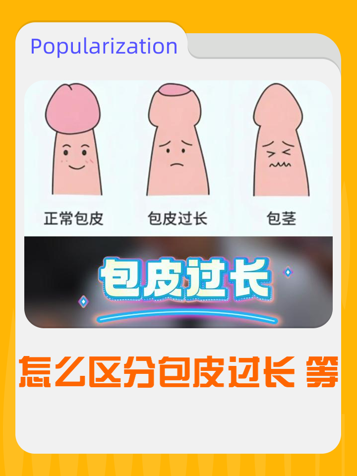 什么是包皮过长,能发个图片吗?