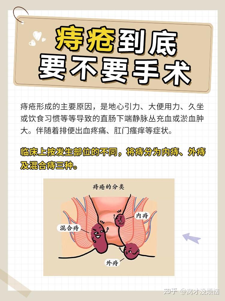 有痔疮能顺产吗