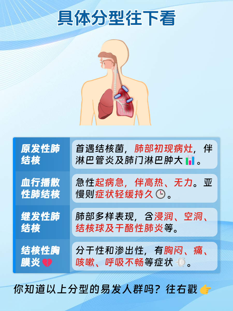 肺结核的相关知识