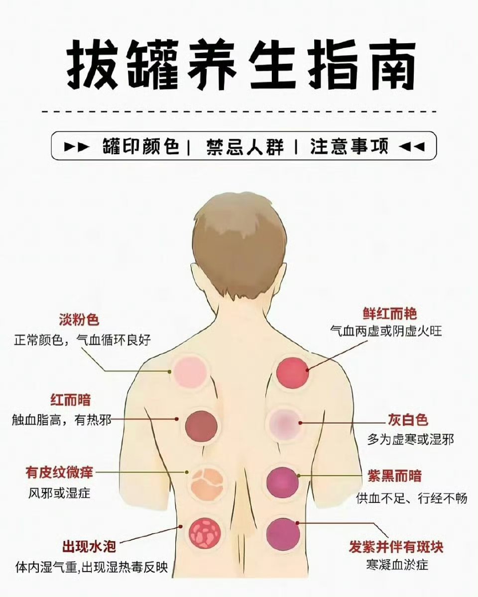 拔罐出水泡是怎么回事