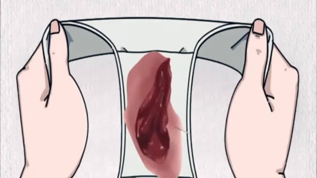 黄体酮低有什么症状