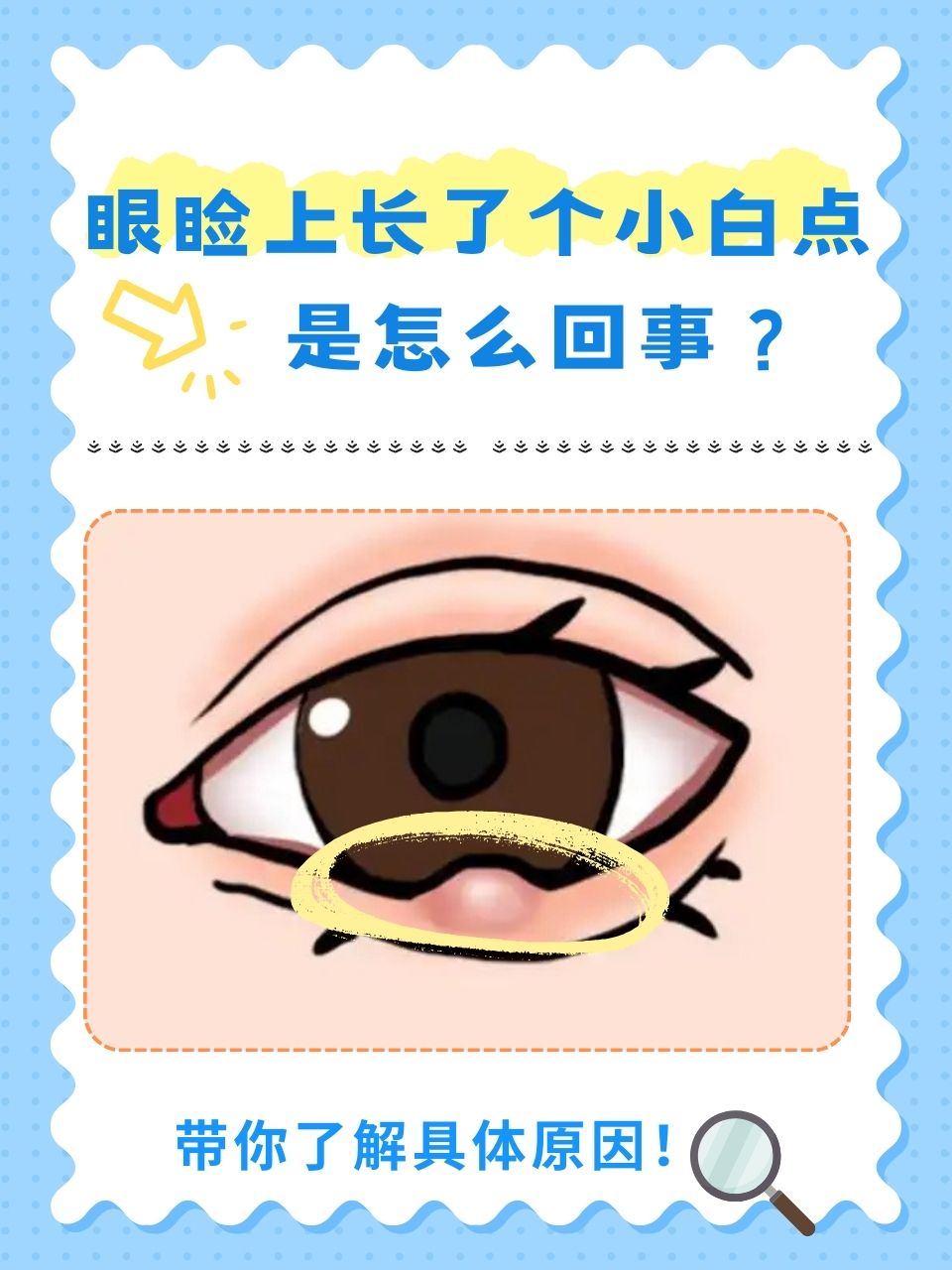 眼睛就一个大一个小是什么原因