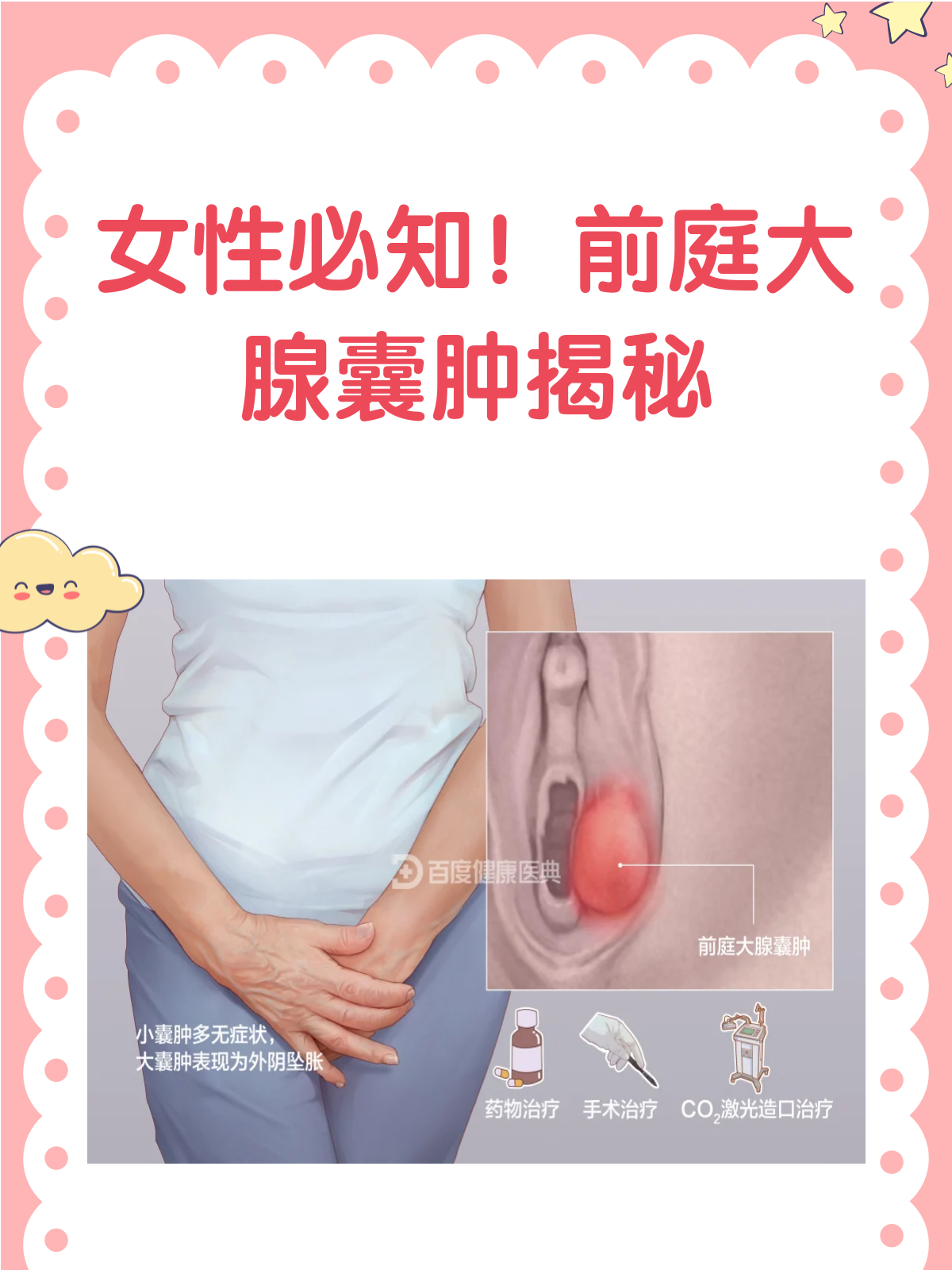 妇科囊肿怎么治