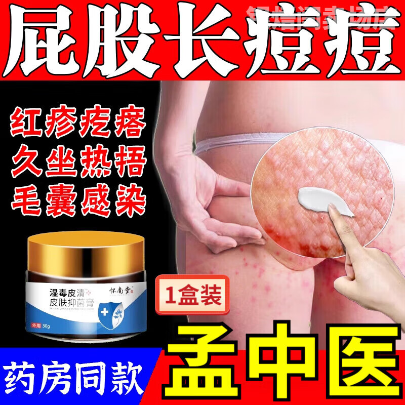 屁股上长痘痘怎么办?