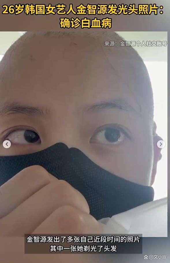 单核细胞白血病的症状