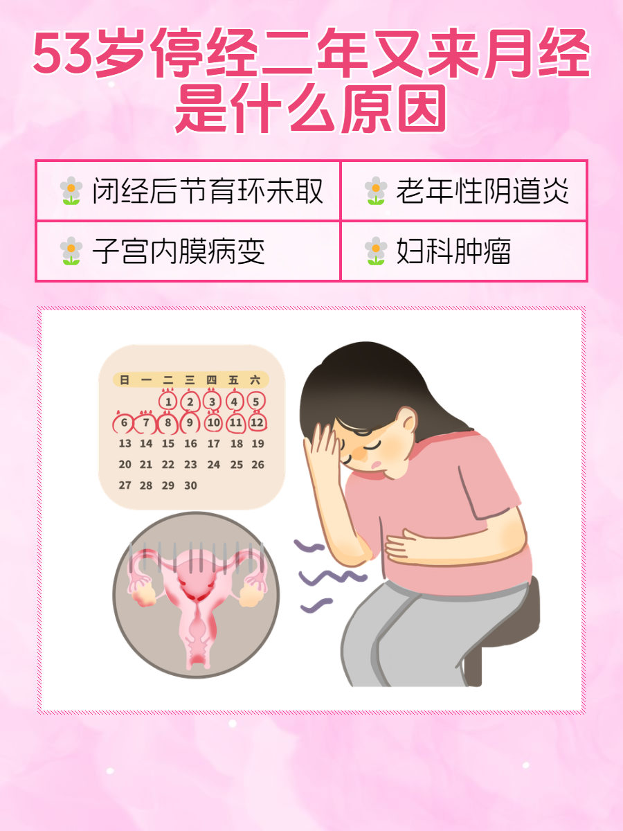 女人绝经的症状有哪些