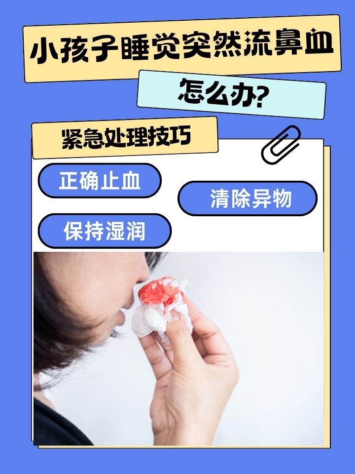 鼻子流血止不住怎么办