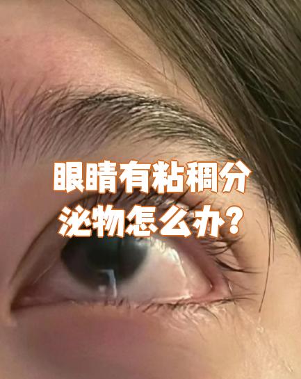 眼睛有白色的粘稠物是怎么了