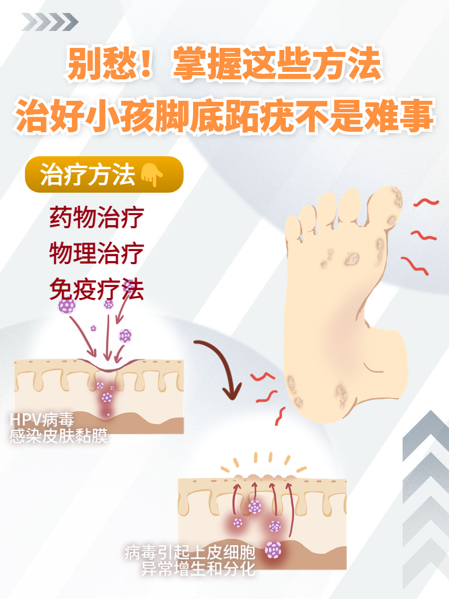 跖疣怎么治疗好得快