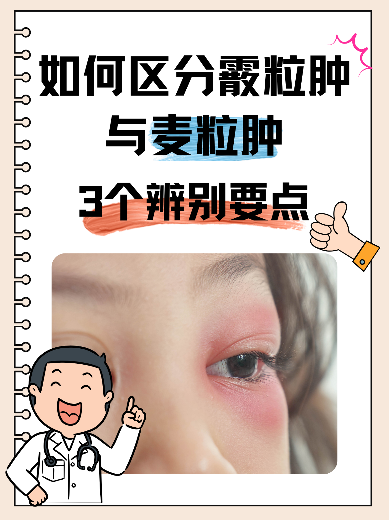 霰粒肿手术后多久可以恢复?