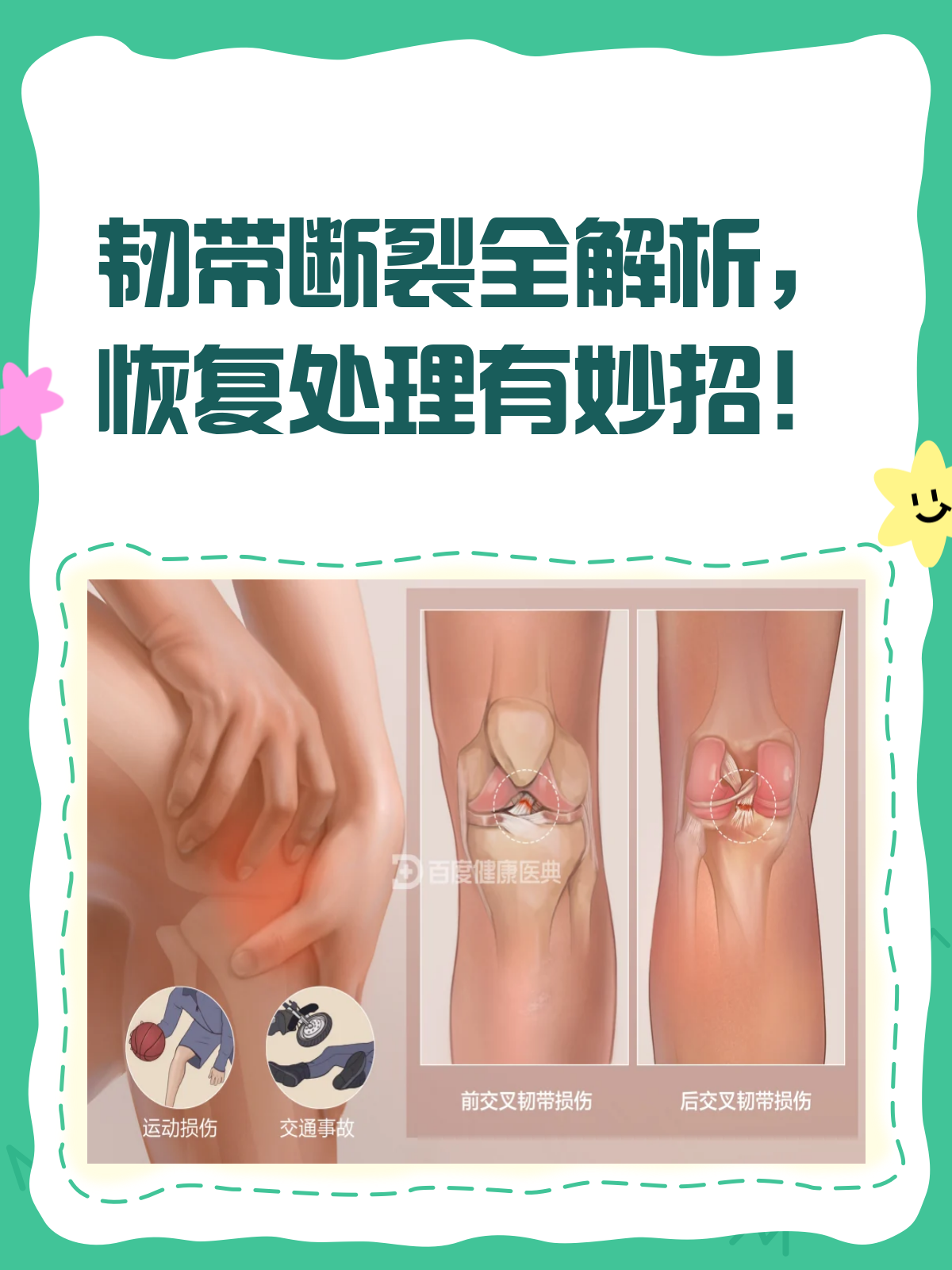 韧带损伤怎么办