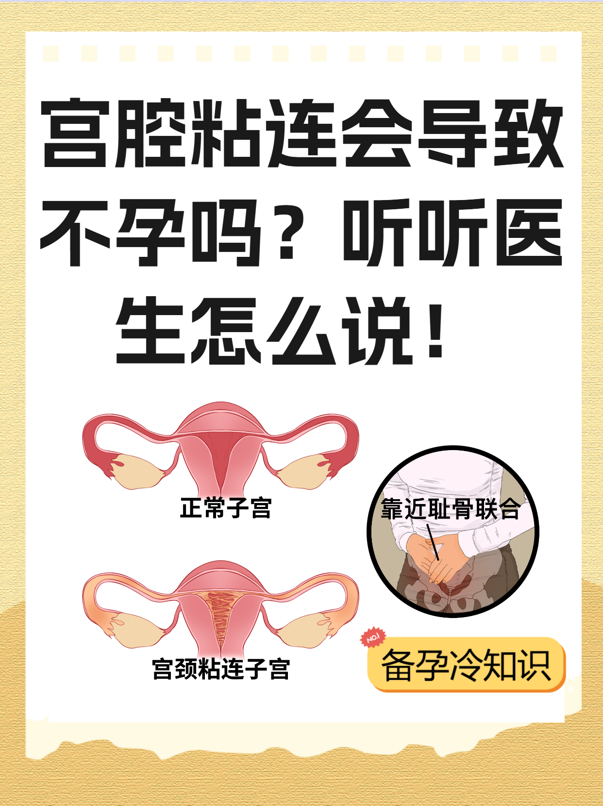 宫腔粘连一定要做手术吗