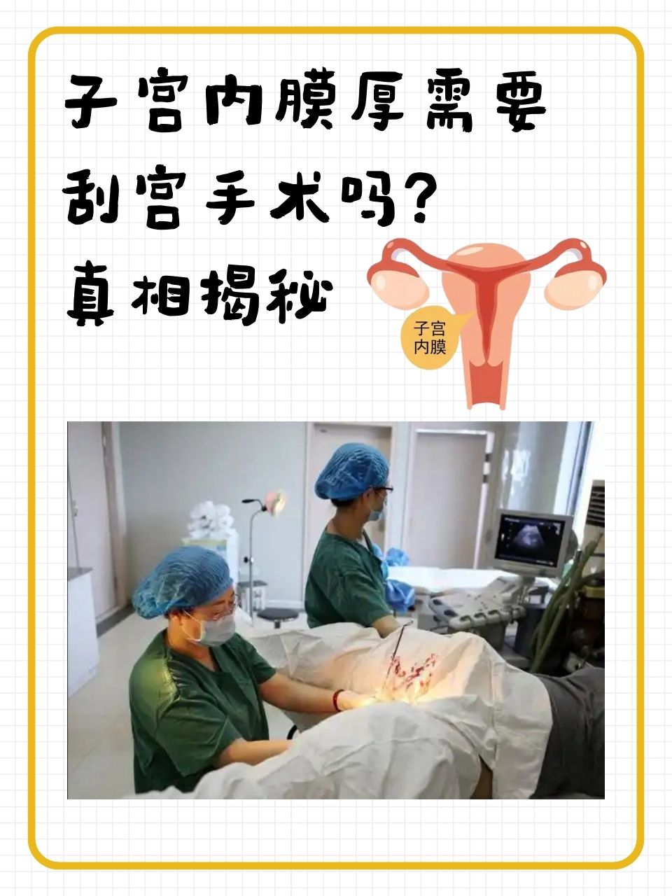 宫腔粘连一定要做手术吗