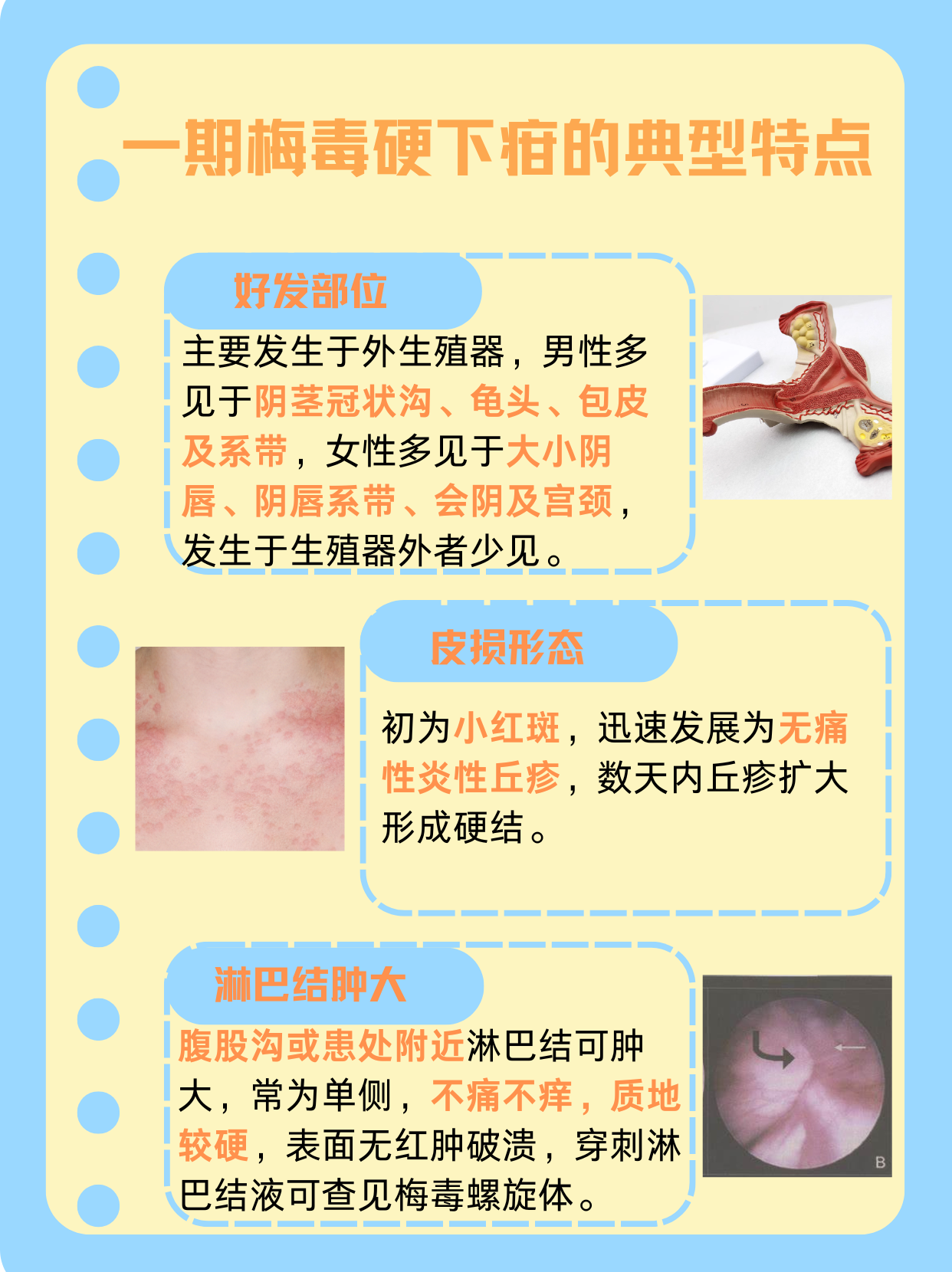 一期梅毒多长时间可以治愈